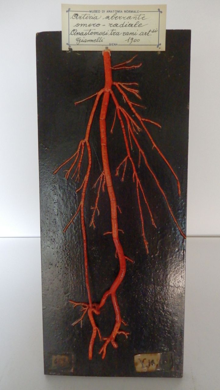 singolo reperto antropologico, preparato anatomico (apparato circolatorio), arteria (morfologia/ struttura alterata post mortem per intervento antropico, trattato e colorato) (fine XIX)