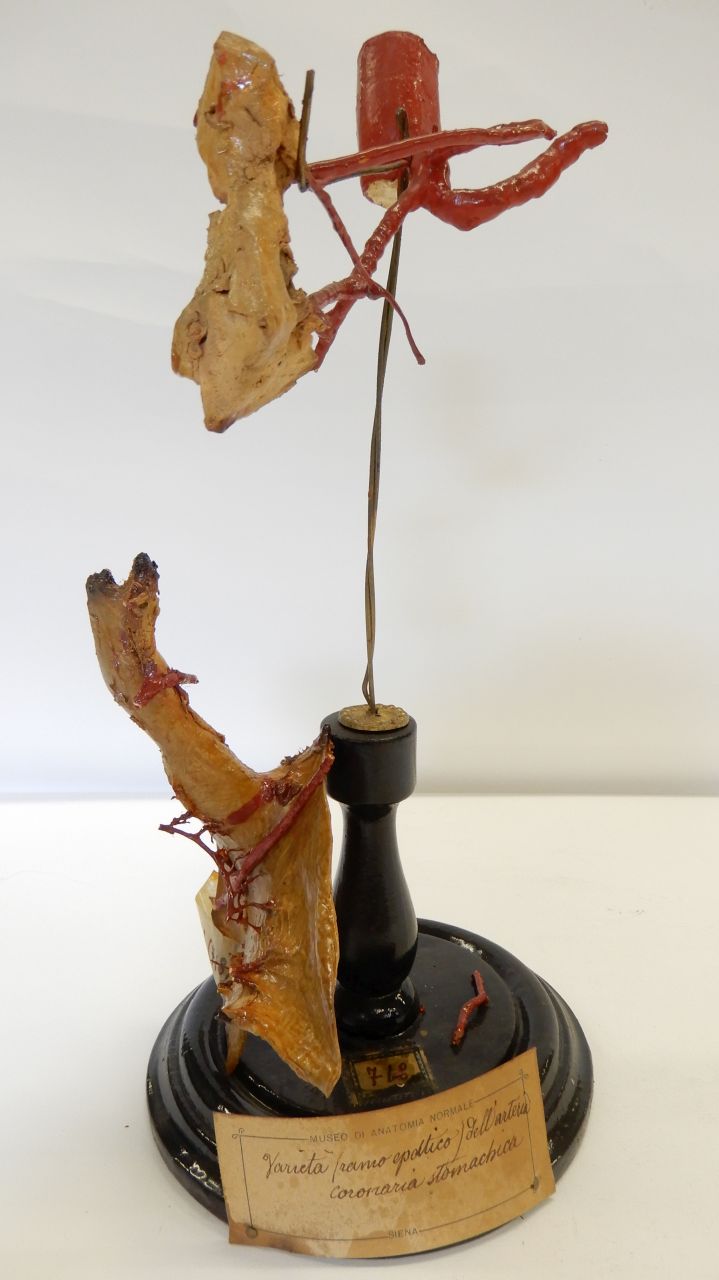 singolo reperto antropologico, preparato anatomico (apparato circolatorio), arteria (morfologia/ struttura alterata post mortem per intervento antropico, trattato e colorato) (XIX)