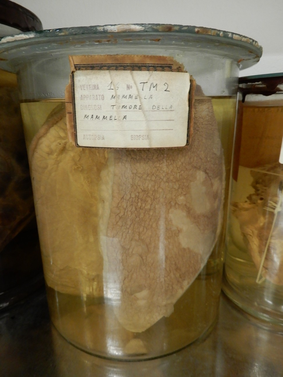 singolo reperto antropologico, preparato anatomico (morfologia alterata per patologia) (XIX-XX)