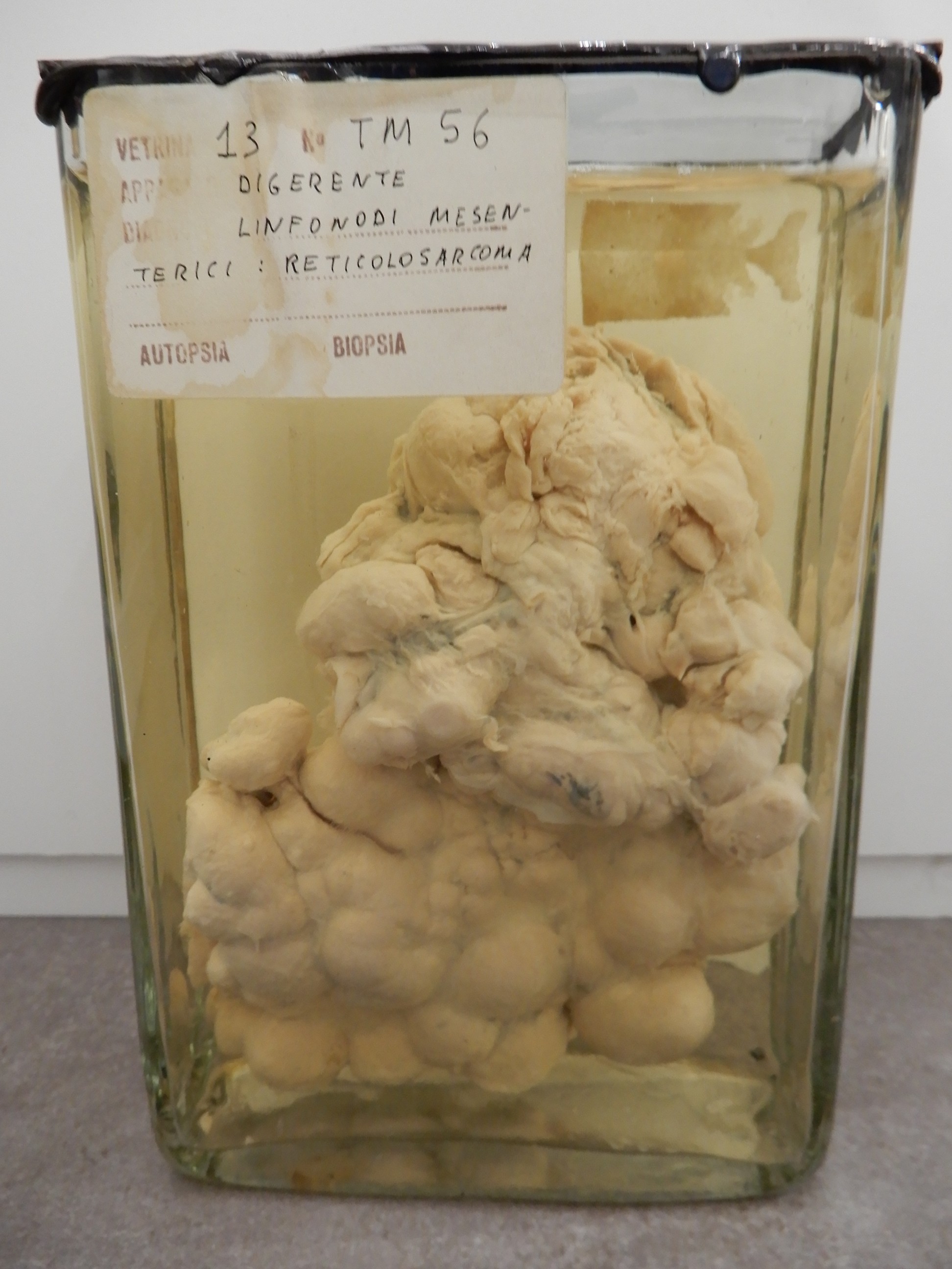 singolo reperto antropologico, preparato anatomico (morfologia alterata per patologia) (XIX-XX)