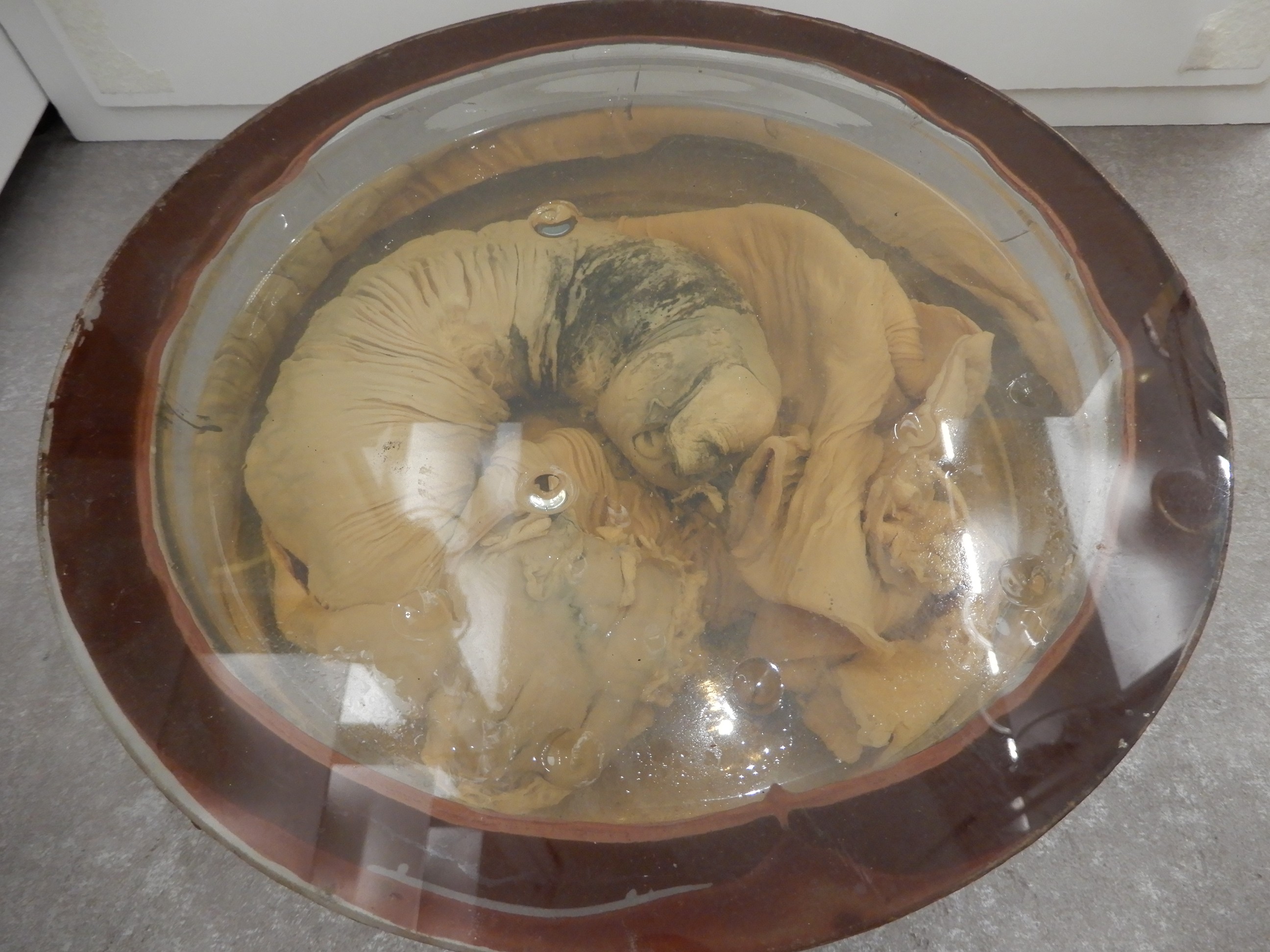 singolo reperto antropologico, preparato anatomico (morfologia alterata per patologia) (XIX-XX)