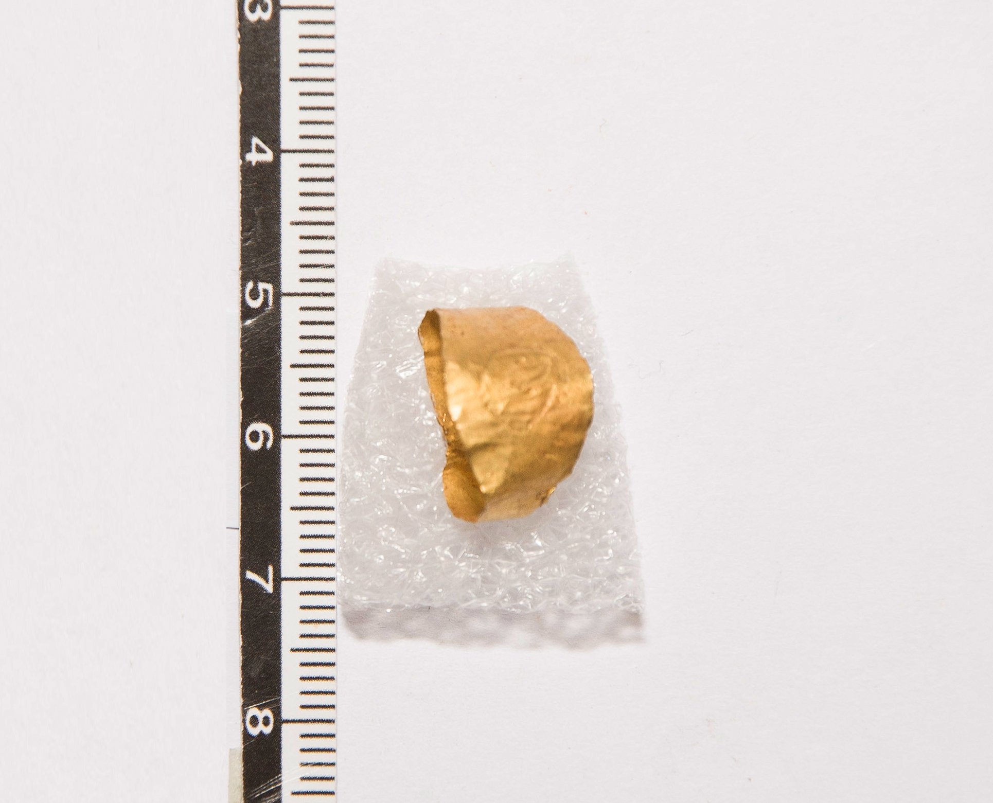 Anello/ digitale