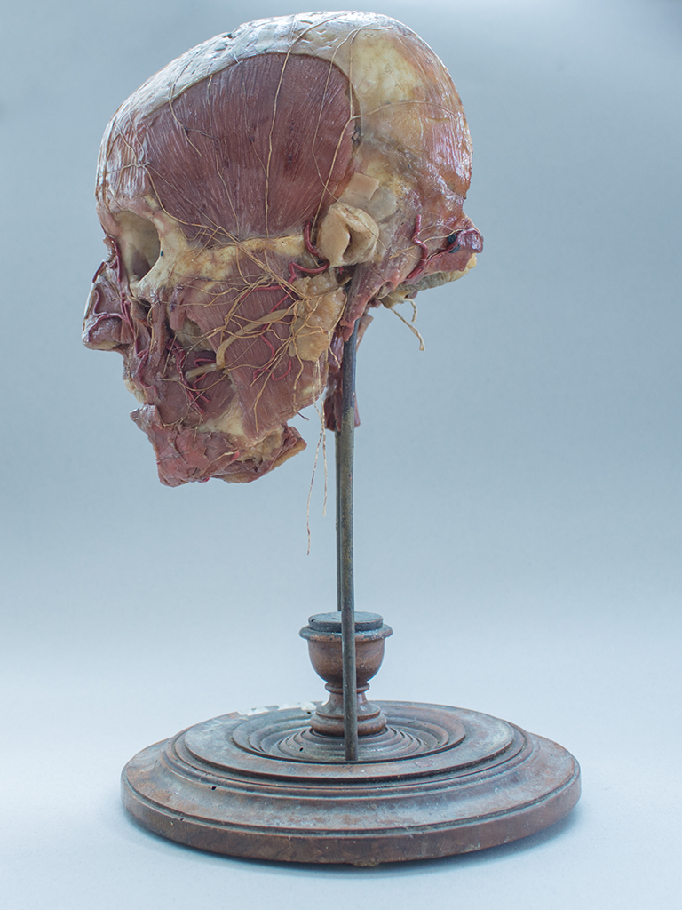 cera anatomica, cranio con materiali organici di Graffeo (attribuito) - scuola ceroplastica siciliana (seconda metà XIX sec)