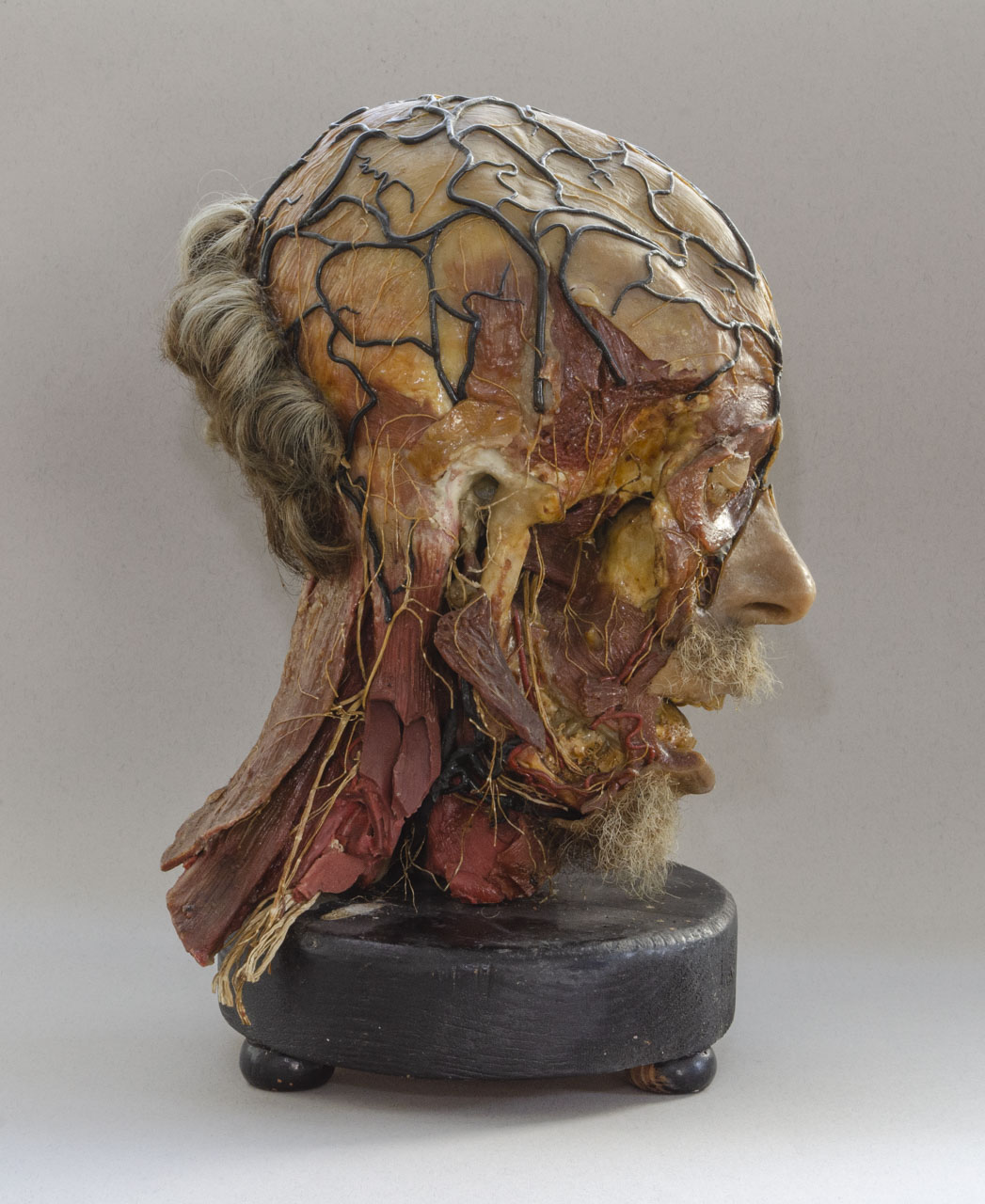 cera anatomica, testa di Graffeo (prima metà Sec. XIX)