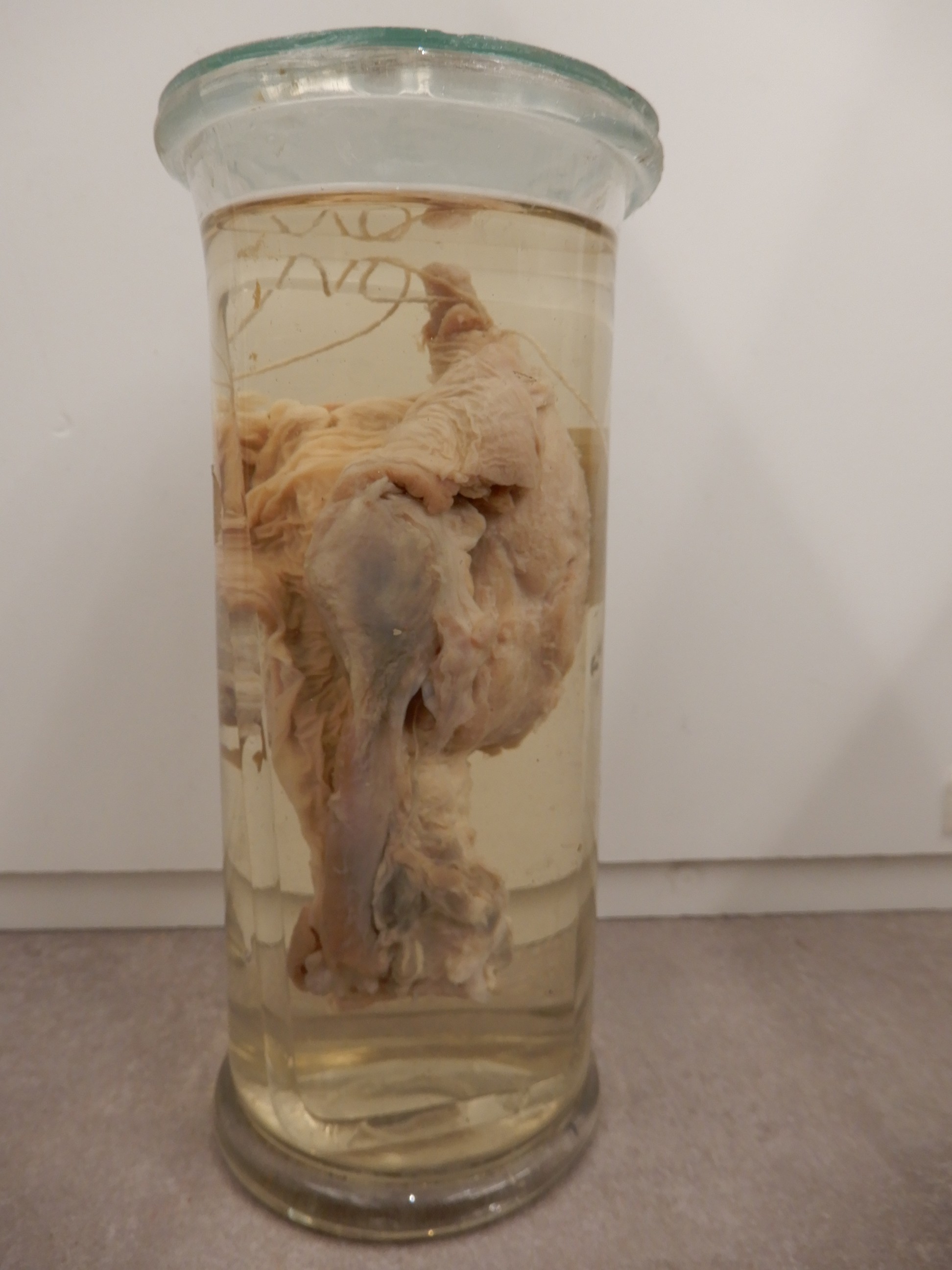 singolo reperto antropologico, preparato anatomico (morfologia alterata per patologia) (XIX-XX)