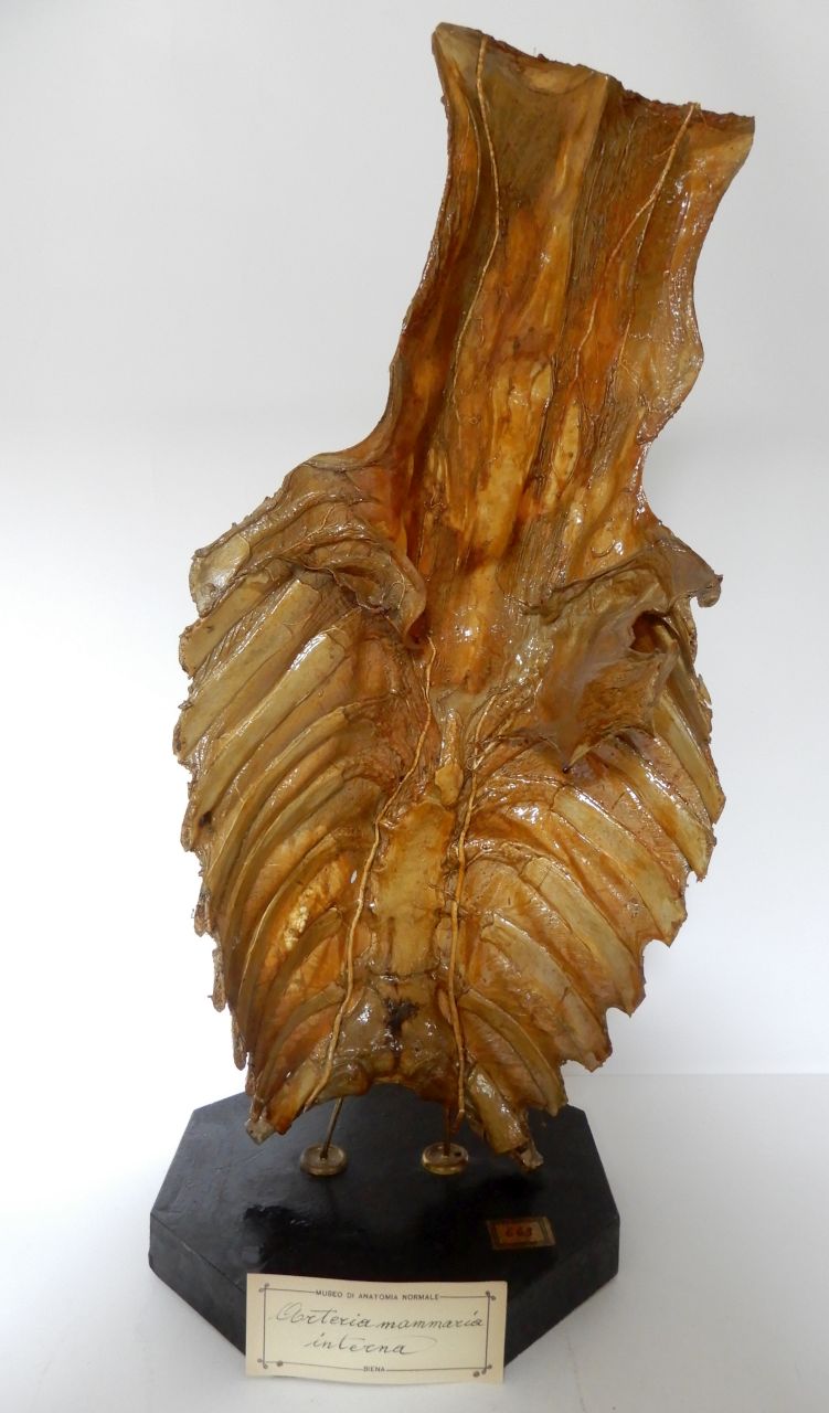 singolo reperto antropologico, preparato anatomico (apparato circolatorio) (XIX)