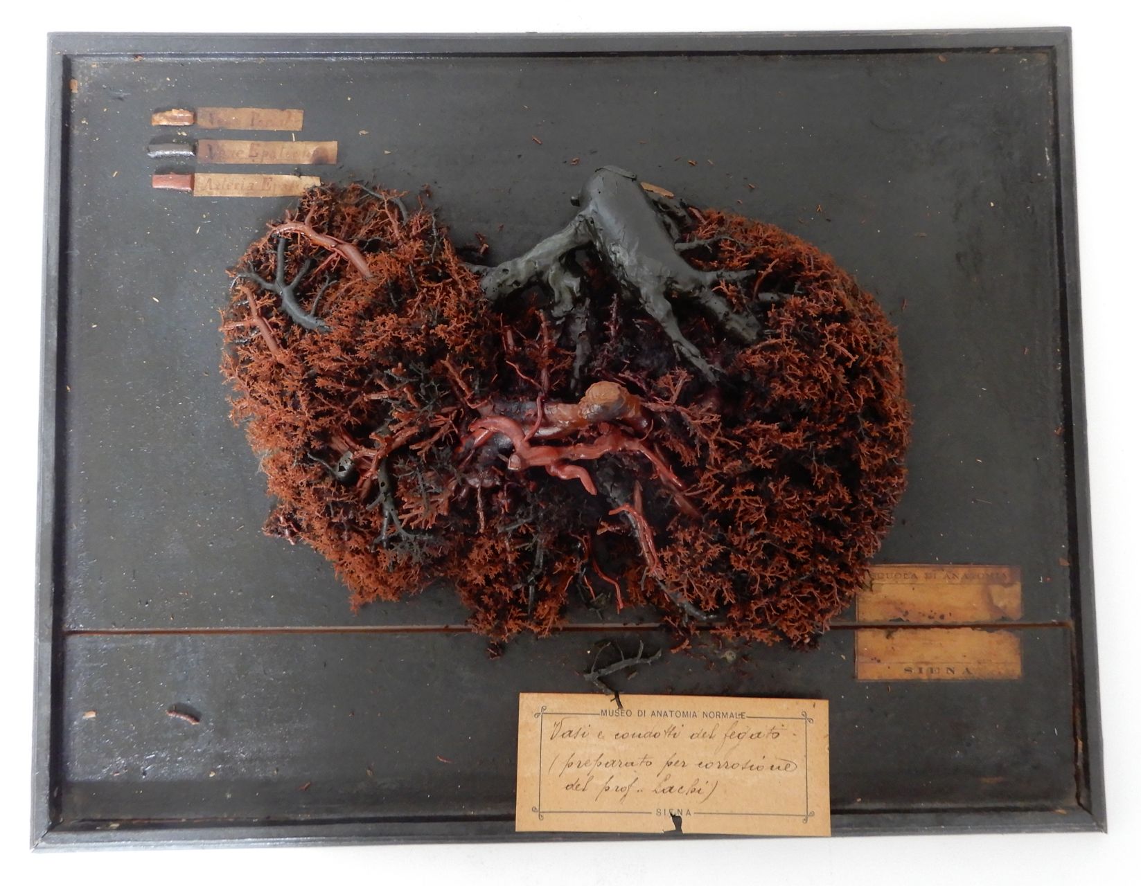 singolo reperto antropologico, fegato (morfologia/ struttura alterata post mortem per intervento antropico, trattato e colorato) (XIX)
