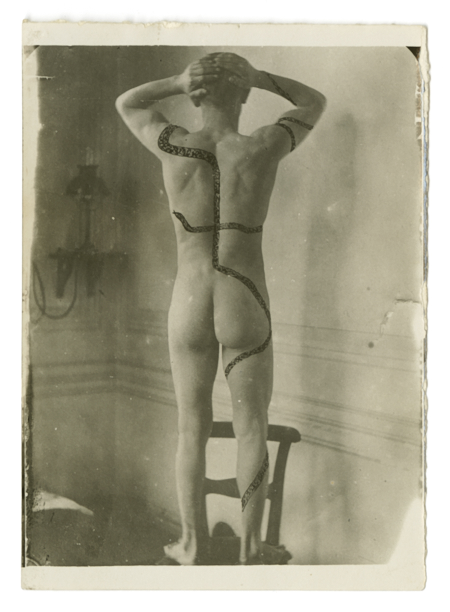 Antropologia - Antropologia Criminale (positivo) di Autore non identificato, Carrara, Mario - fotografia medica (inizio XX)