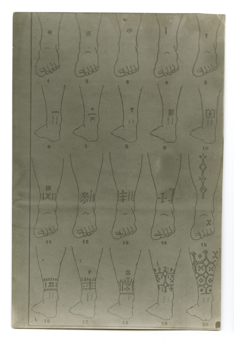 Riproduzione fotografica, tecniche (positivo) di Autore non identificato, Carrara, Mario - fotografia medica (fine/ metà XIX-XX)