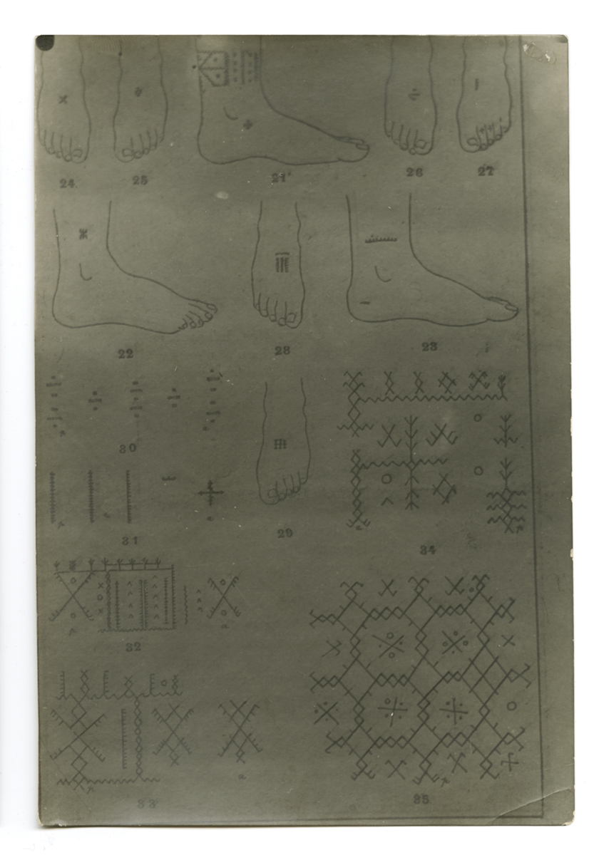 Riproduzione fotografica, tecniche (positivo) di Autore non identificato, Carrara, Mario - fotografia medica (fine/ metà XIX-XX)