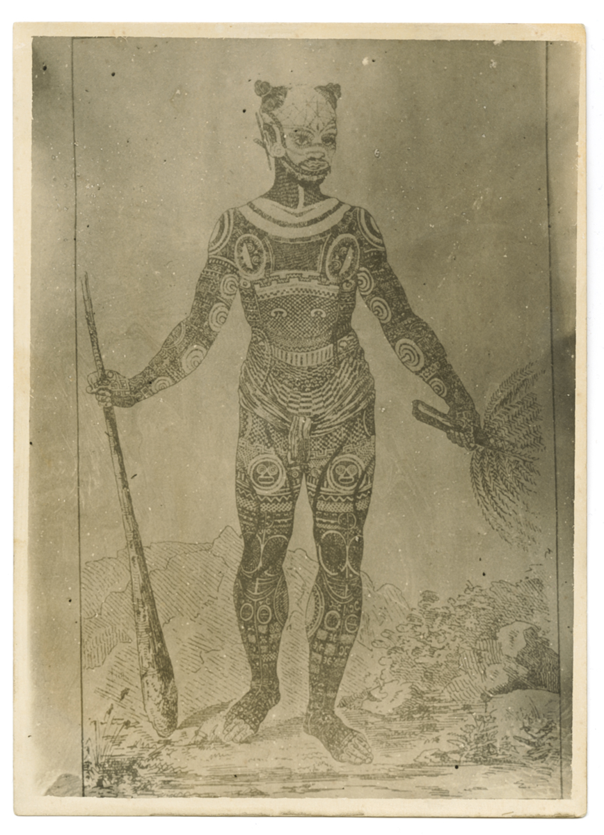 Ritratti - Nudità (positivo) di Autore non identificato, Carrara, Mario - fotografia medica (fine/ metà XIX-XX)