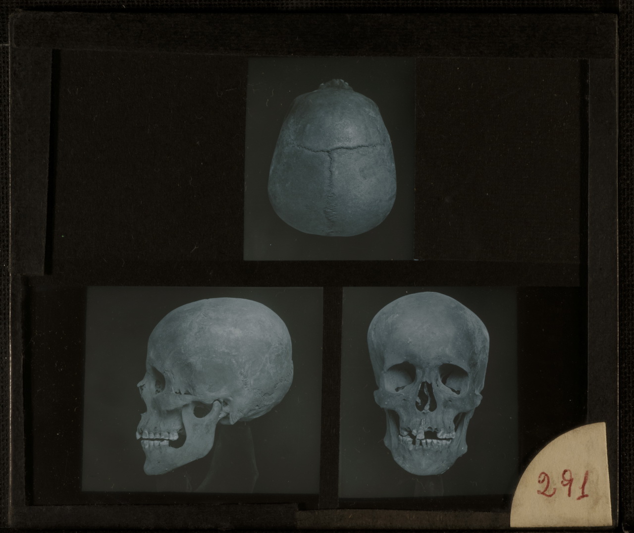 Marro, Ritratti fotografici, Ossa, Cranio (positivo) di Marro, Giovanni (attribuito) - Missione Archeologia Italiana in Egitto (prima metà XX)