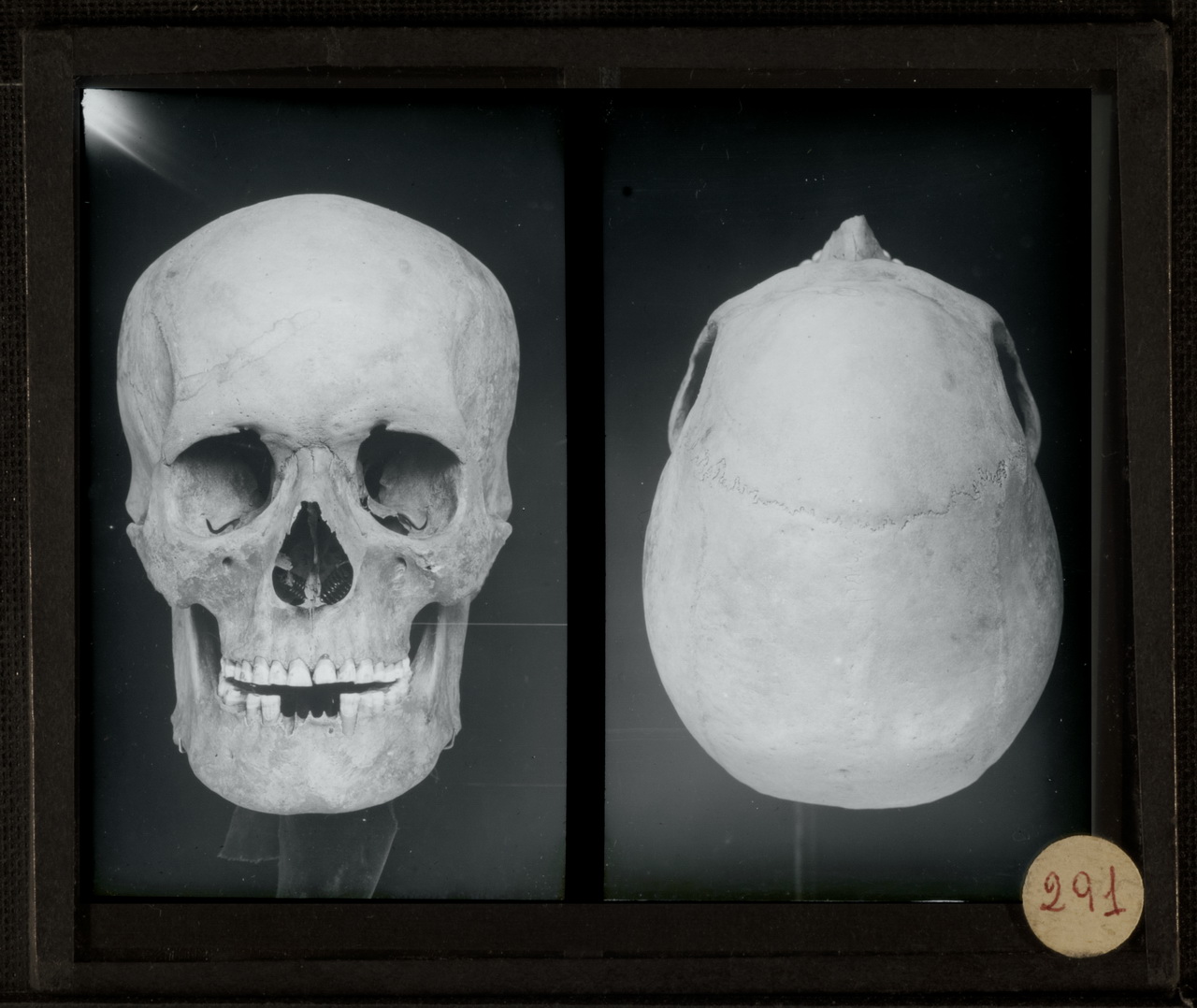 Marro, Ritratti fotografici, Ossa, Cranio (positivo) di Marro, Giovanni (attribuito) - Missione Archeologia Italiana in Egitto (prima metà XX)