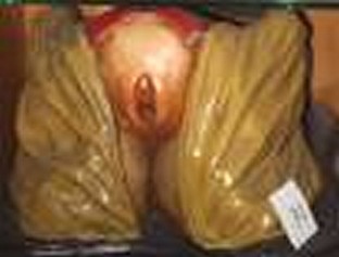 singolo reperto antropologico, Modello anatomico (SECOLI/ ARCHI DI SECOLI/ XVIII-XIX)