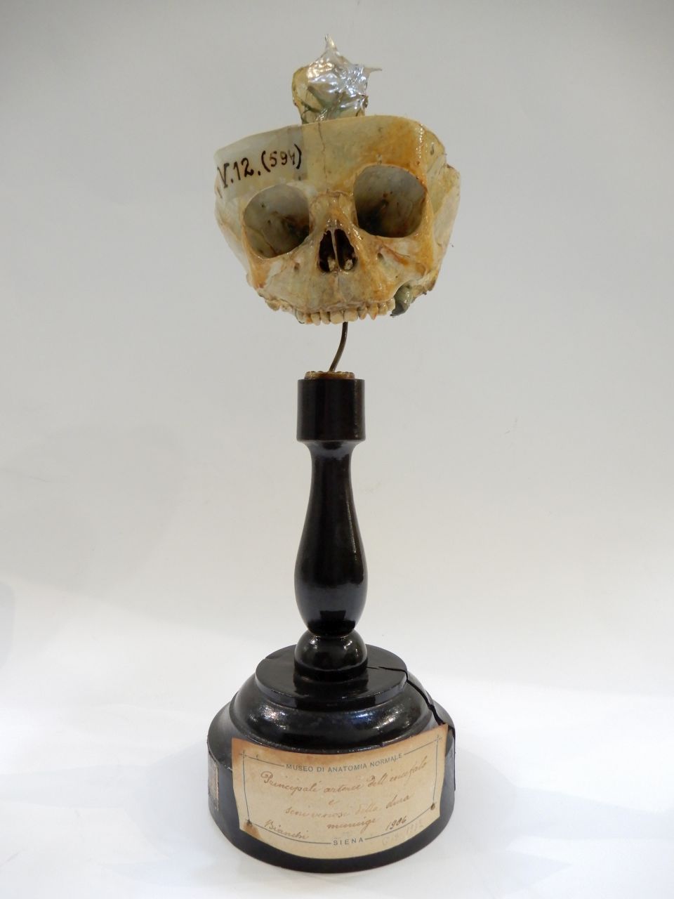 singolo reperto antropologico, preparato anatomico (apparato circolatorio), cranio (morfologia/ struttura alterata post mortem per intervento antropico, trattato e colorato) (XX)