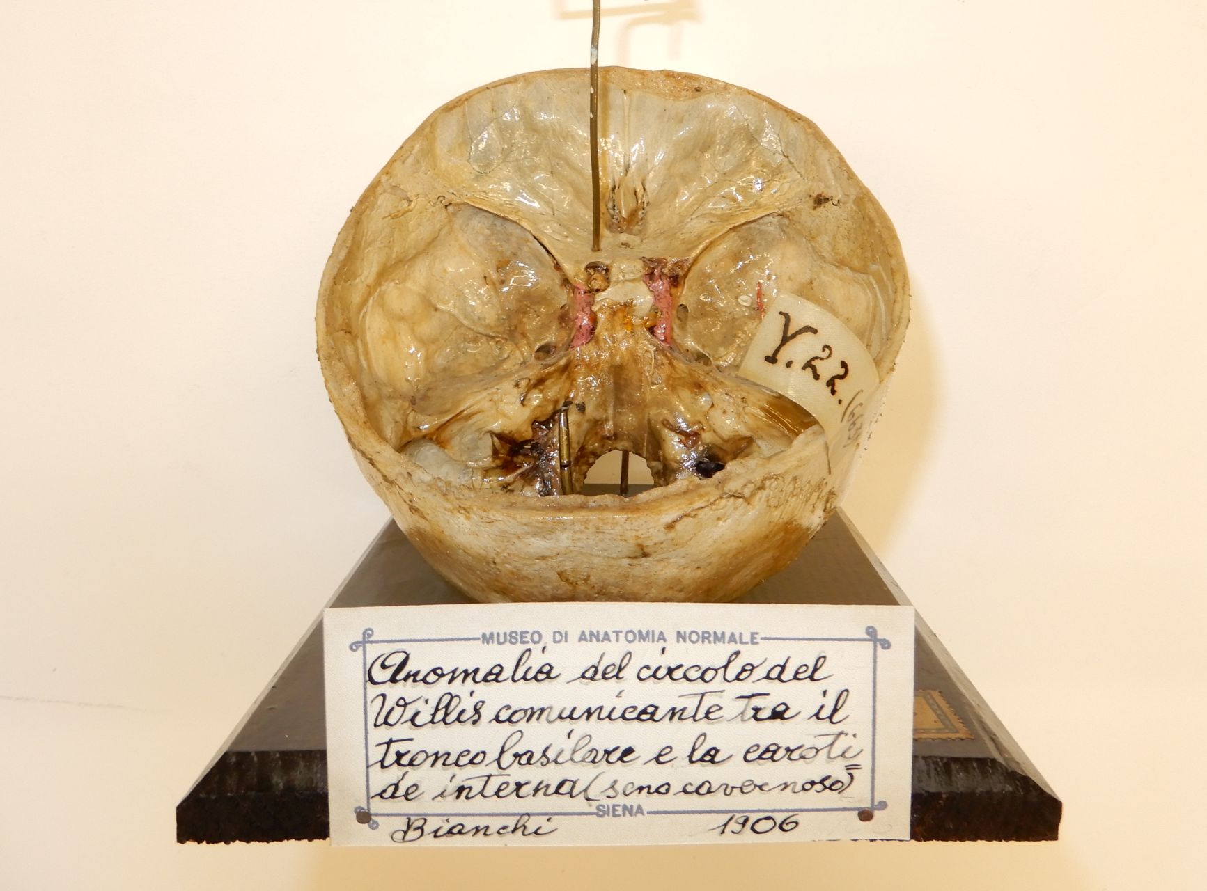 singolo reperto antropologico, preparato anatomico (apparato circolatorio) (morfologia/ struttura alterata post mortem per intervento antropico, trattato con fissante) (XX)