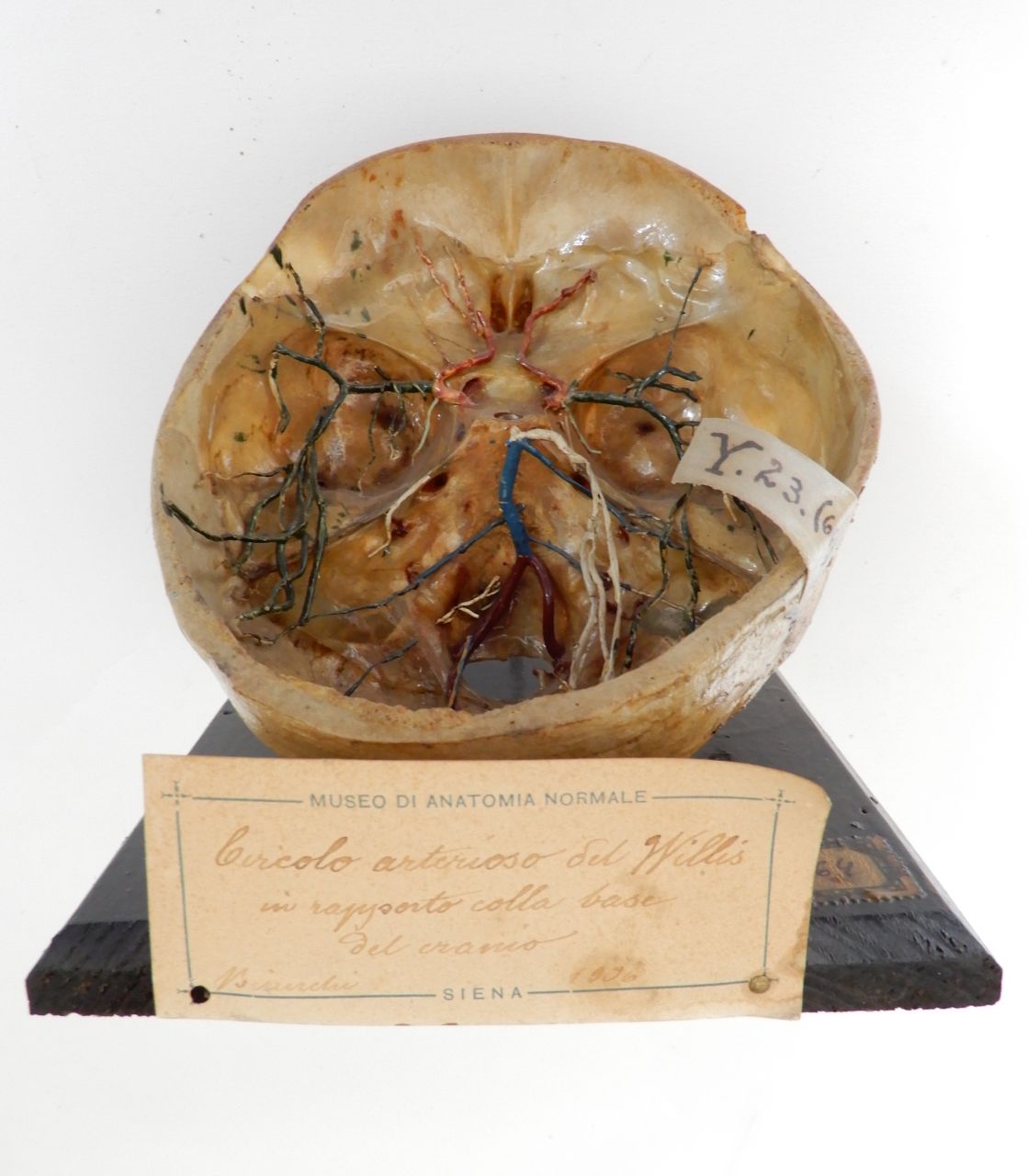 singolo reperto antropologico, preparato anatomico (apparato circolatorio) (morfologia/ struttura alterata post mortem per intervento antropico, trattato con fissante) (XX)