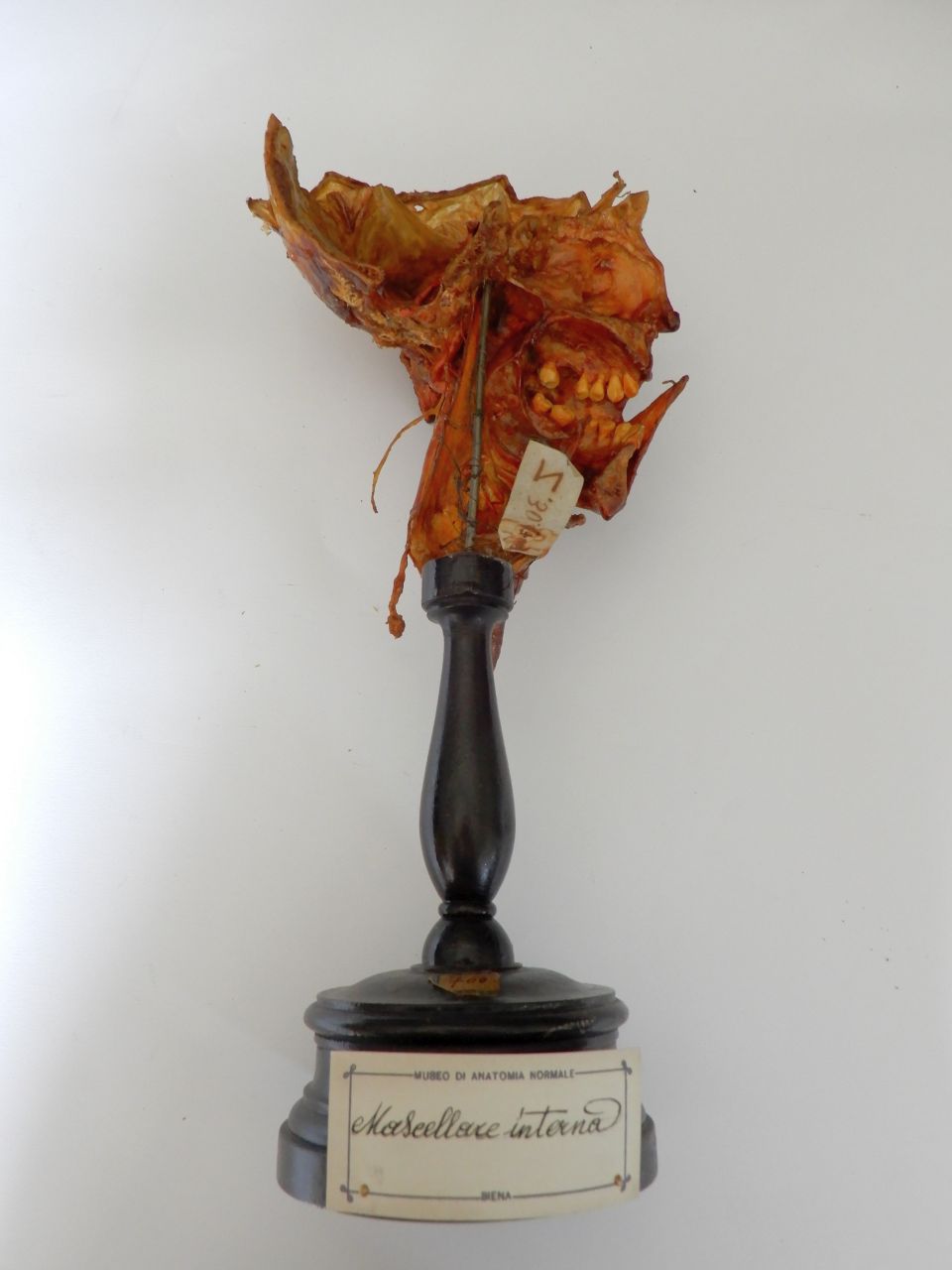 singolo reperto antropologico, preparato anatomico (inizio XX)