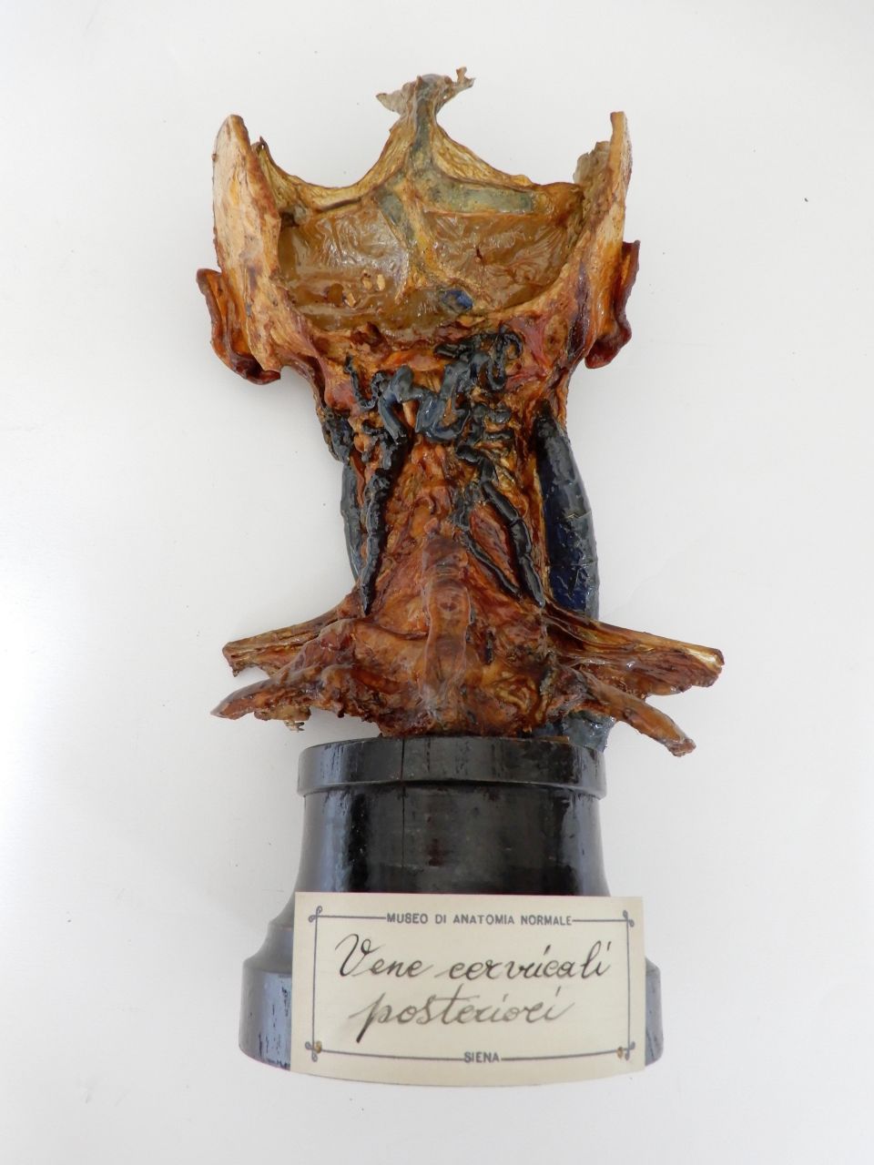 singolo reperto antropologico, preparato anatomico (apparato circolatorio) (morfologia/ struttura alterata post mortem per intervento antropico, trattato con fissante) (fine XIX)