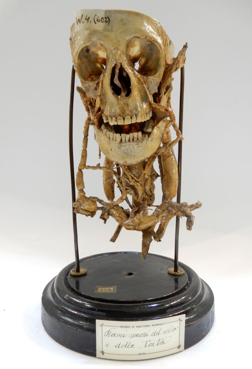 singolo reperto antropologico, preparato anatomico (apparato circolatorio) (morfologia/ struttura alterata post mortem per intervento antropico, trattato con fissante) (XIX)