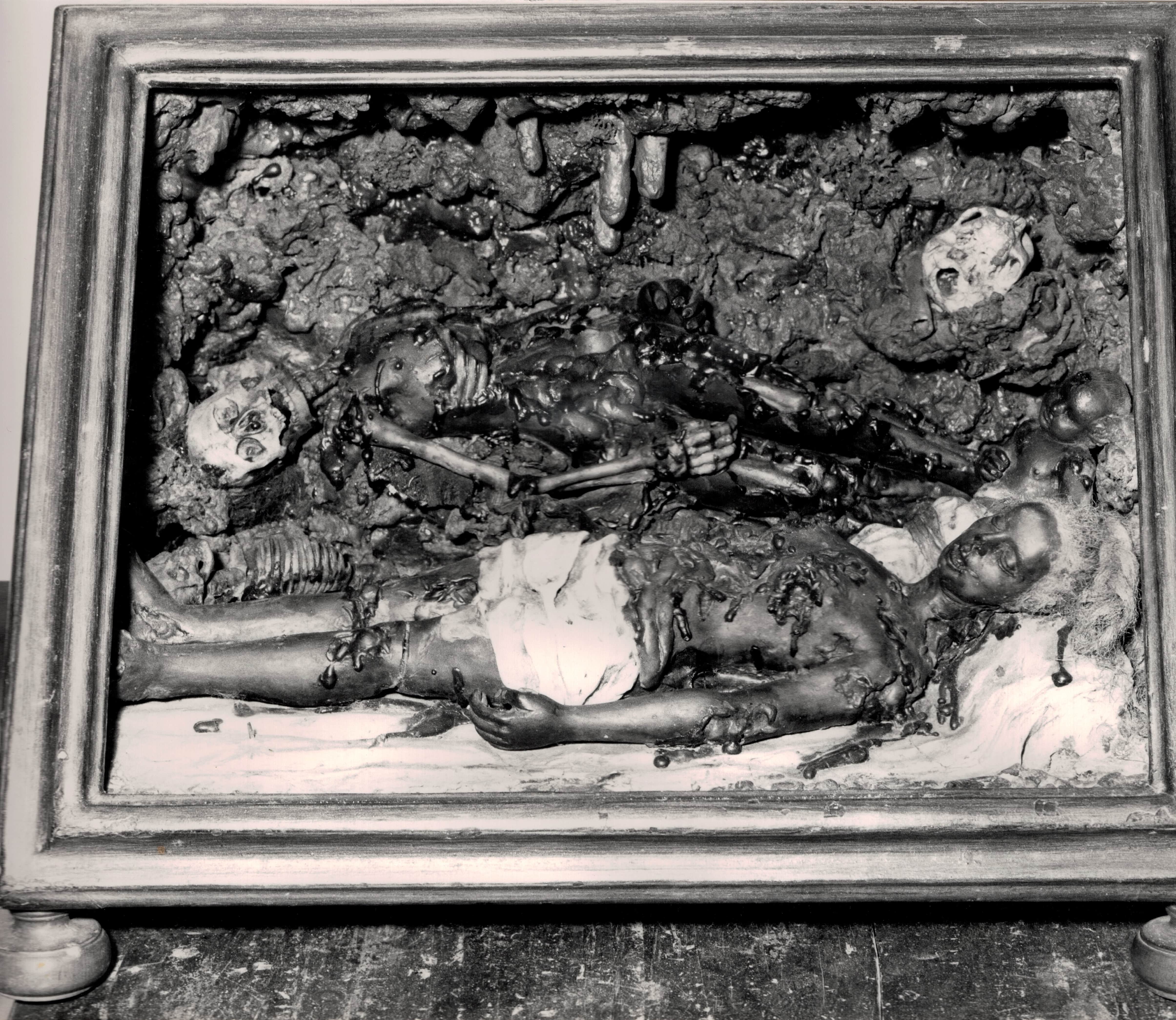 La decomposizione, corpo decomposto (cera anatomica, insieme) - bottega toscana (XVIII)