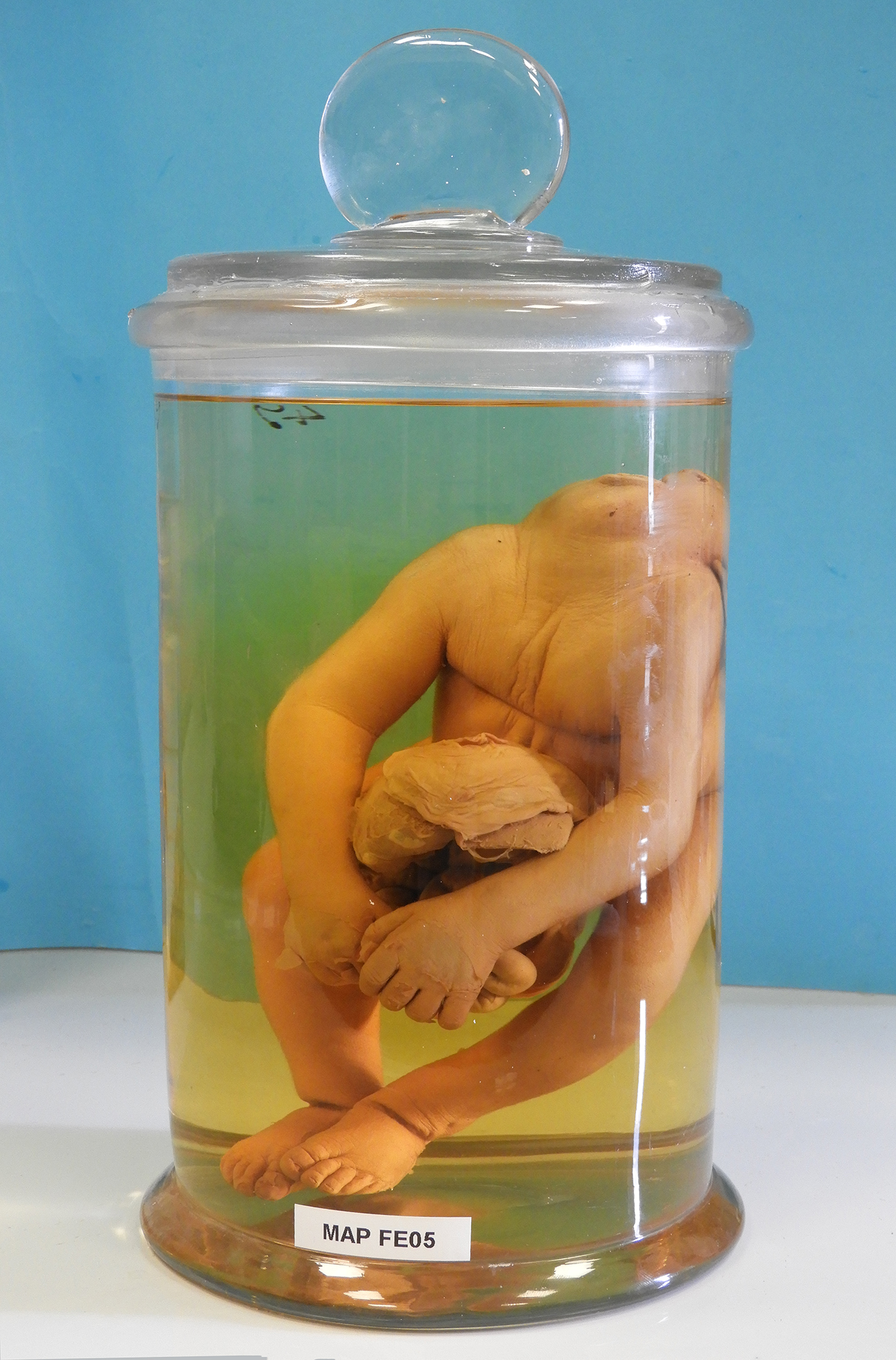 preparato anatomico, feto (morfologia naturale) (prima metà SECOLI/ XIX)