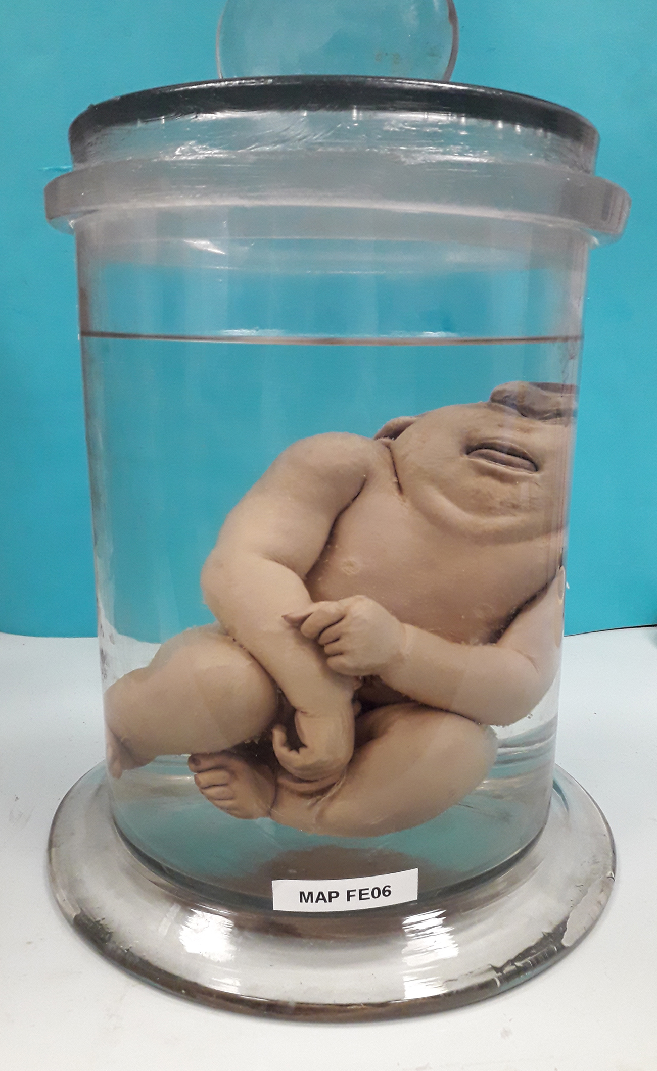 preparato anatomico, feto (morfologia naturale) (prima metà SECOLI/ XIX)