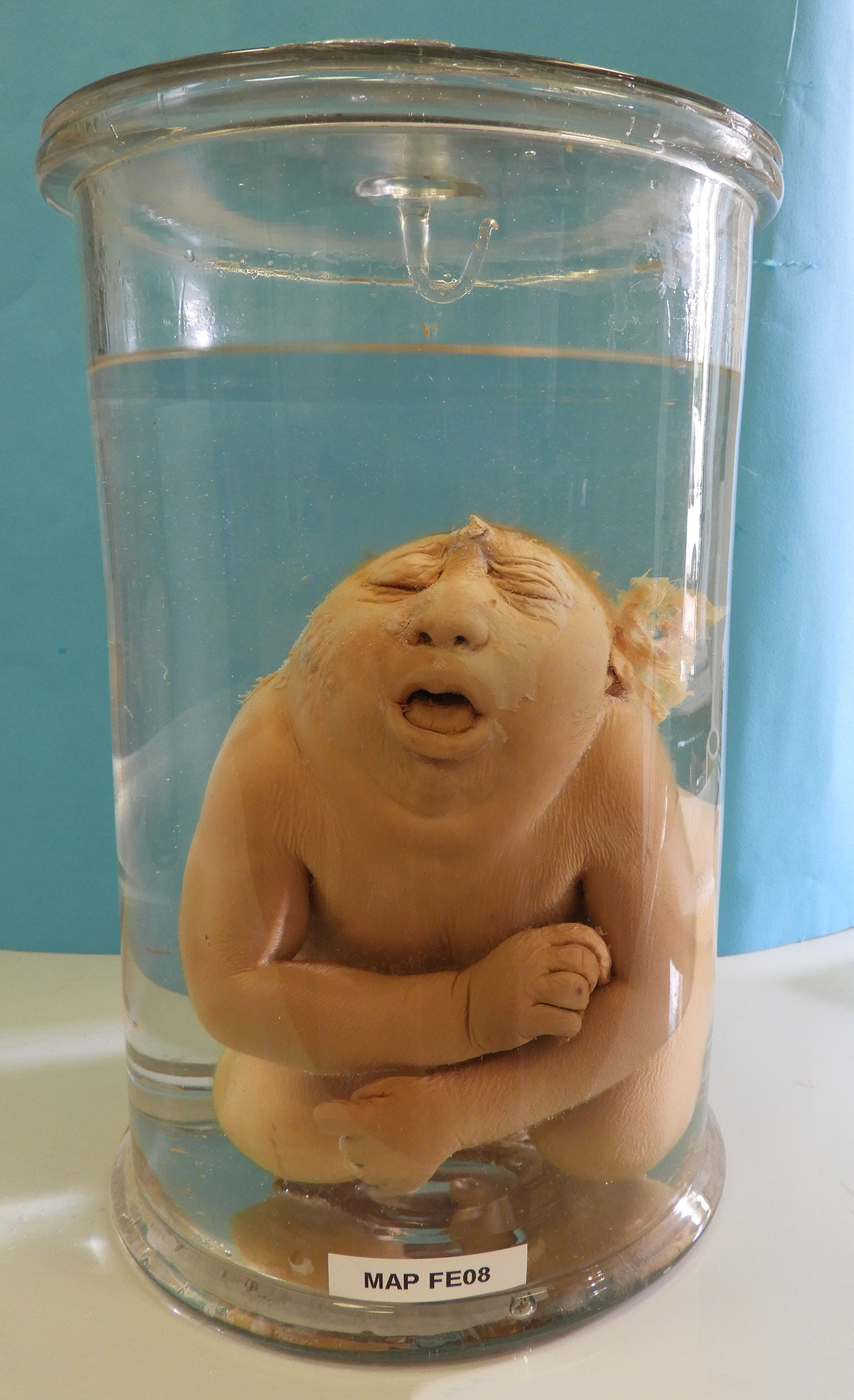 preparato anatomico, feto (morfologia naturale) (prima metà SECOLI/ XIX)