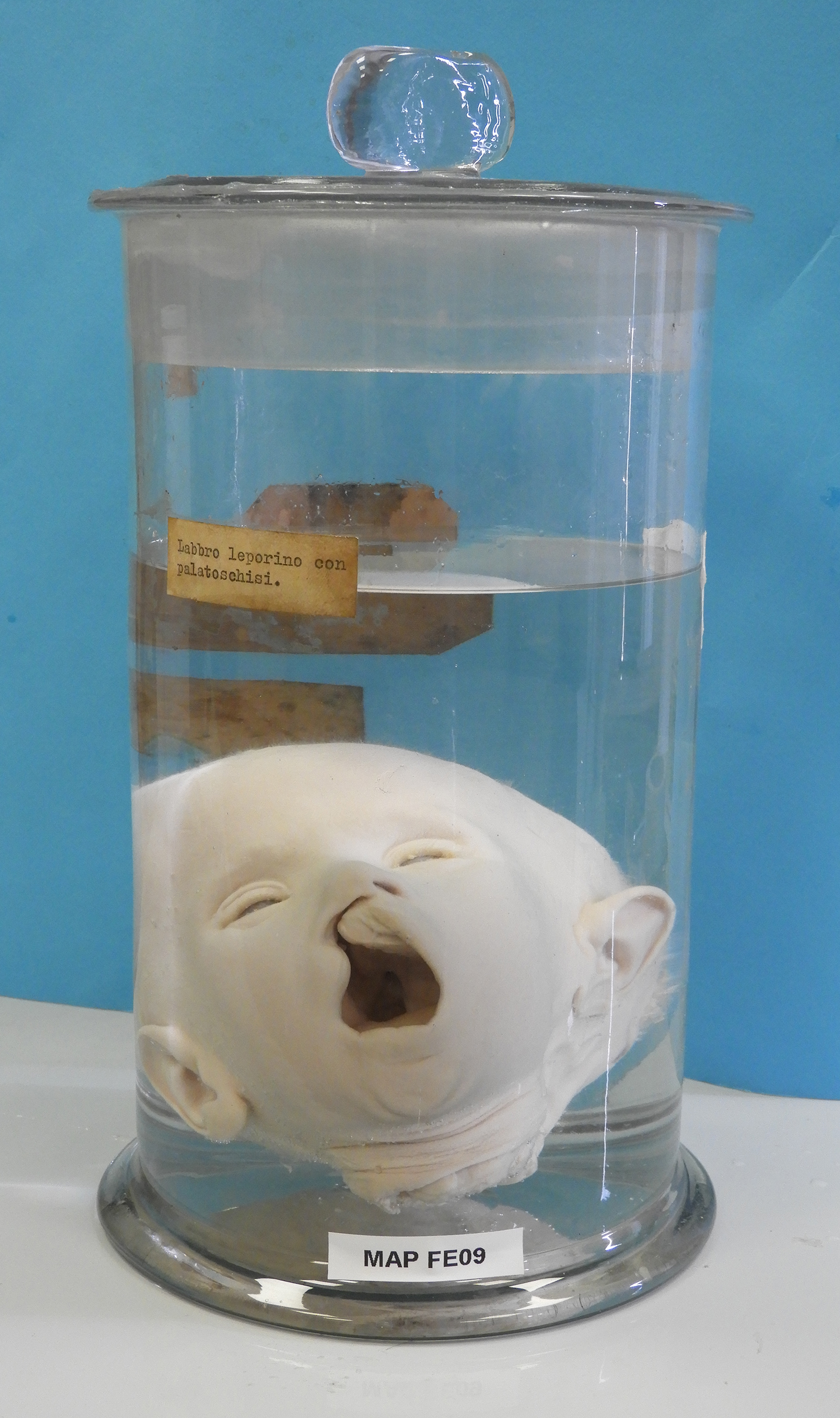 preparato anatomico, individuo infantile (morfologia naturale) (prima metà SECOLI/ XIX)