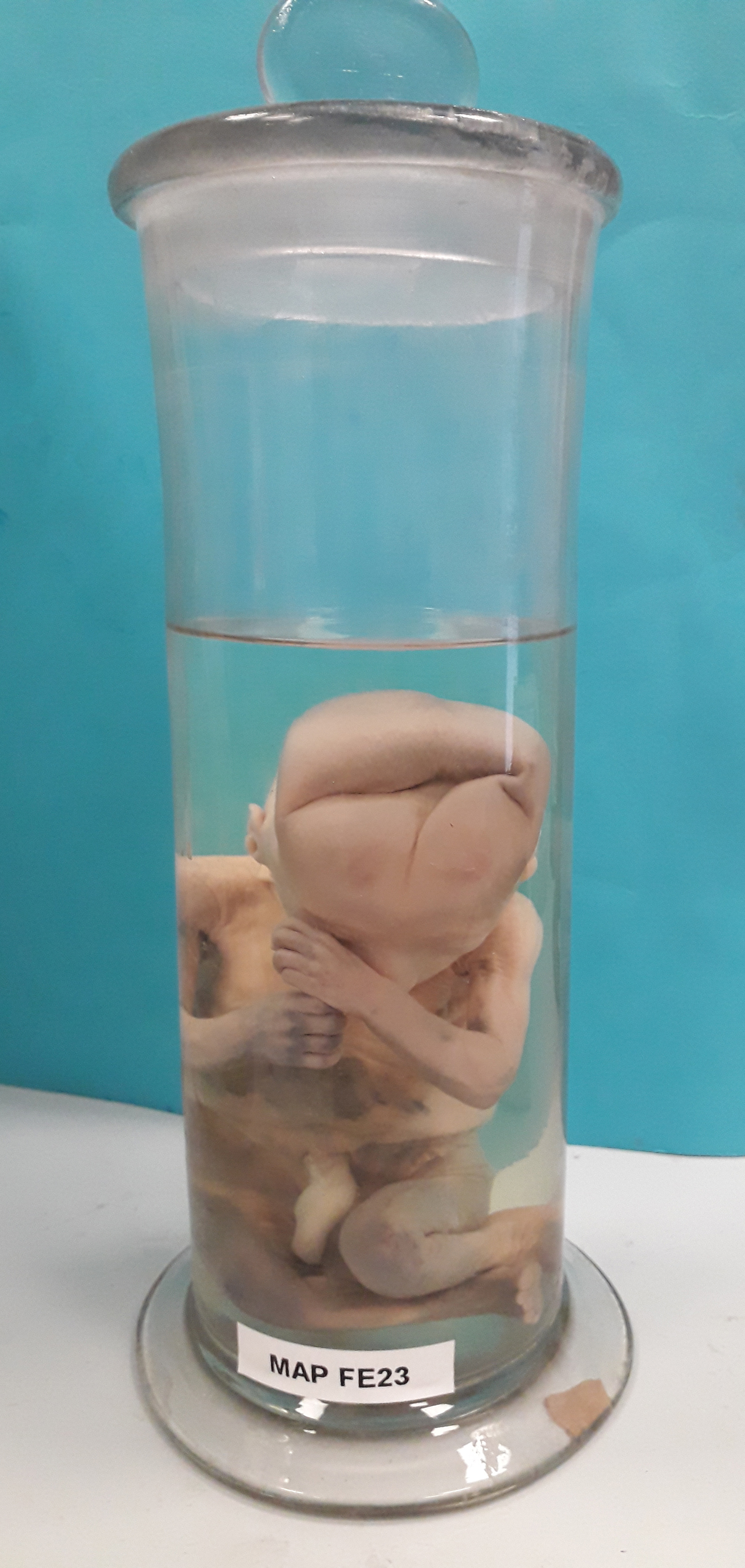 preparato anatomico, feto (morfologia naturale) (prima metà SECOLI/ XIX)