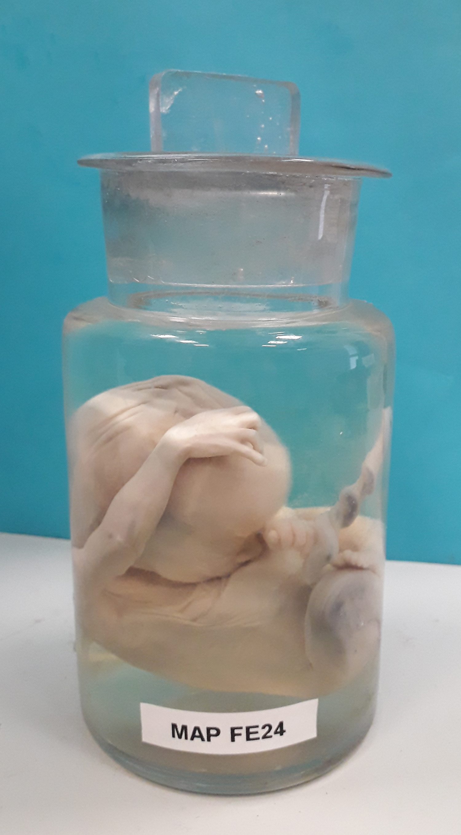 preparato anatomico, feto (morfologia naturale) (prima metà SECOLI/ XIX)