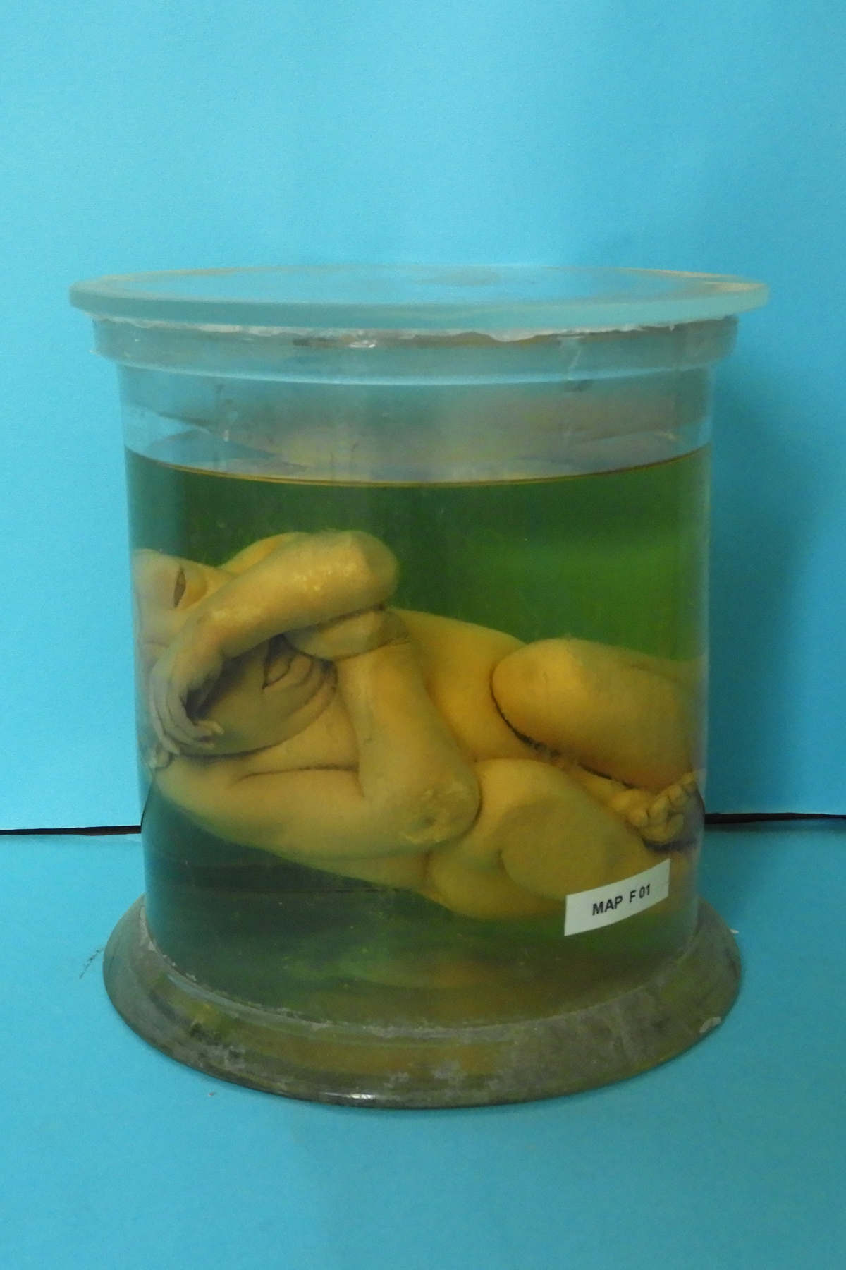 preparato anatomico, feto (morfologia naturale) (prima metà SECOLI/ XIX)