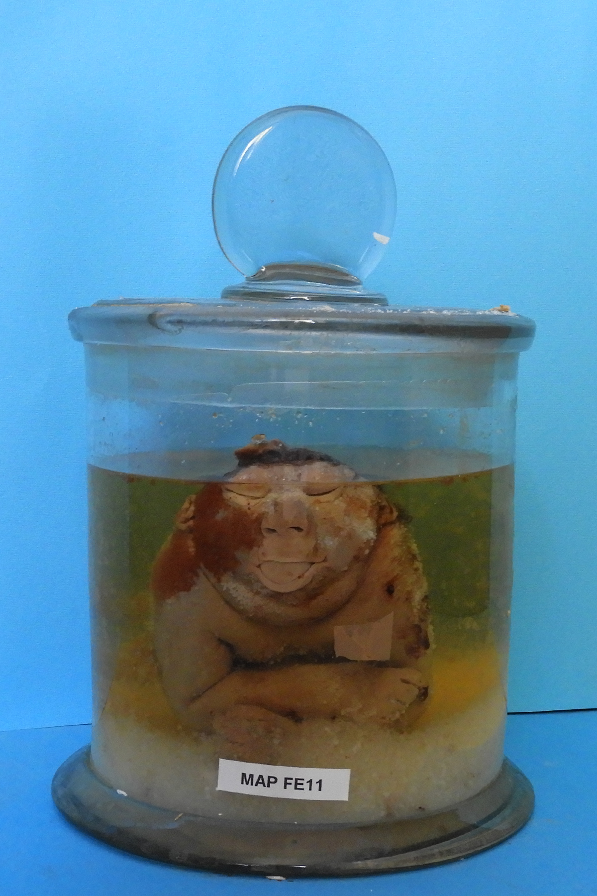 preparato anatomico, feto (morfologia naturale) (prima metà SECOLI/ XIX)