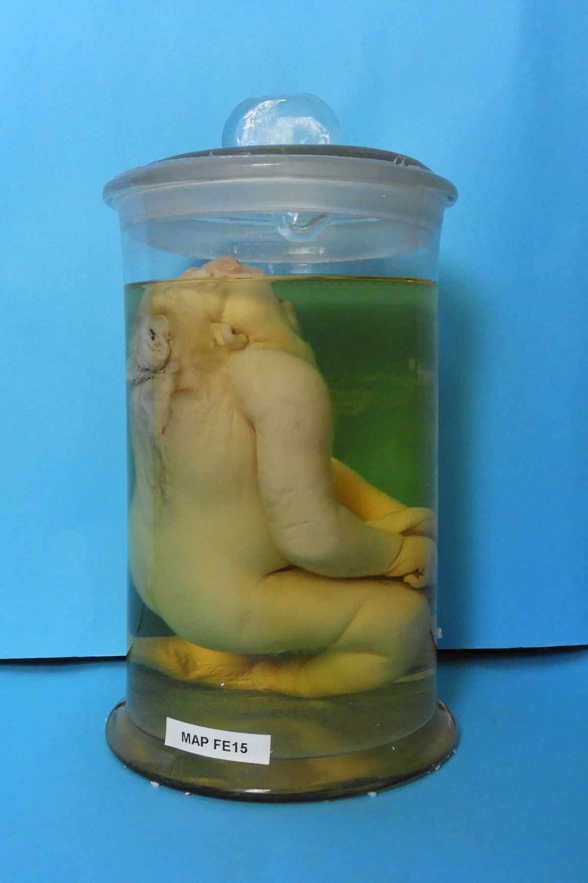 preparato anatomico, feto (morfologia naturale) (prima metà SECOLI/ XIX)