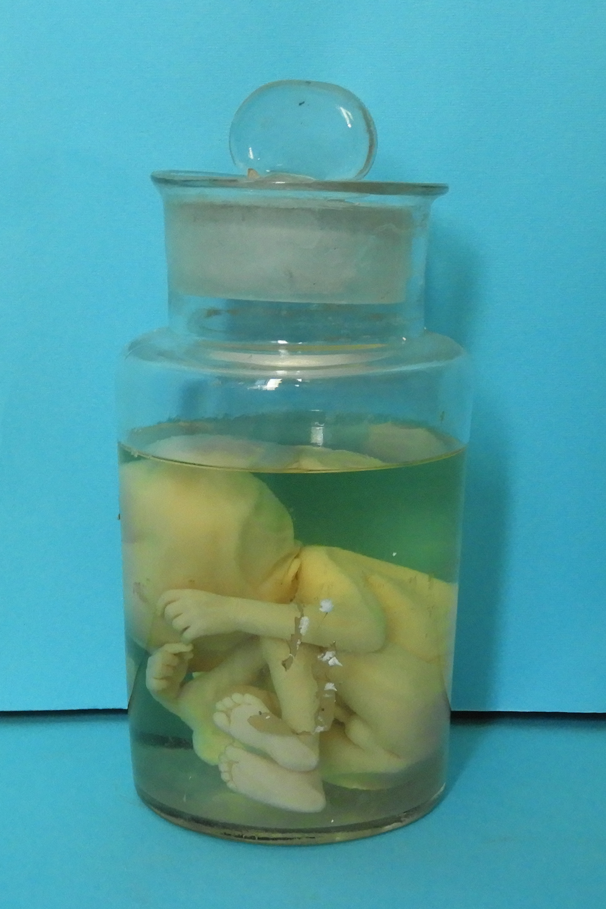 preparato anatomico, feto (morfologia naturale) (prima metà SECOLI/ XIX)