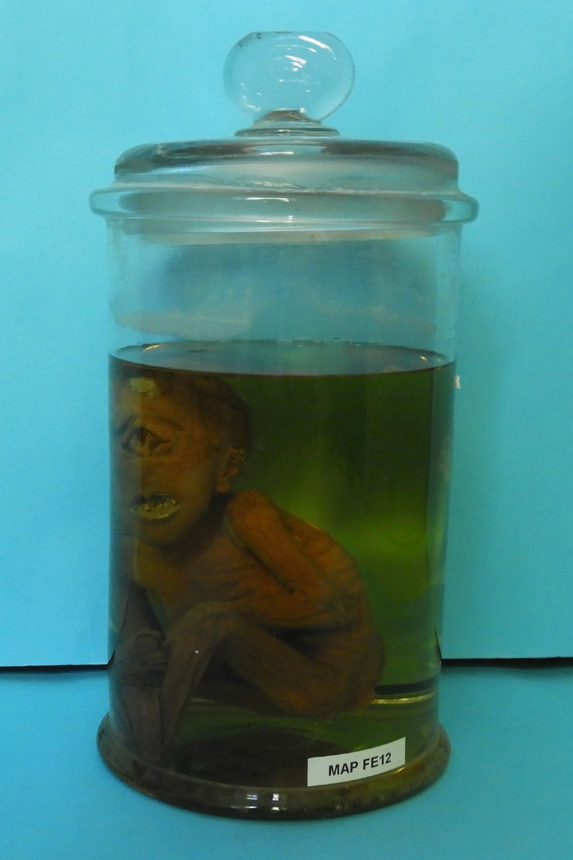 preparato anatomico, feto (morfologia naturale) (prima metà SECOLI/ XIX)