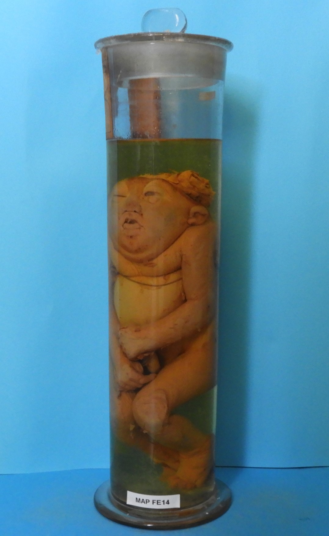 preparato anatomico, feto (morfologia naturale) (prima metà SECOLI/ XIX)