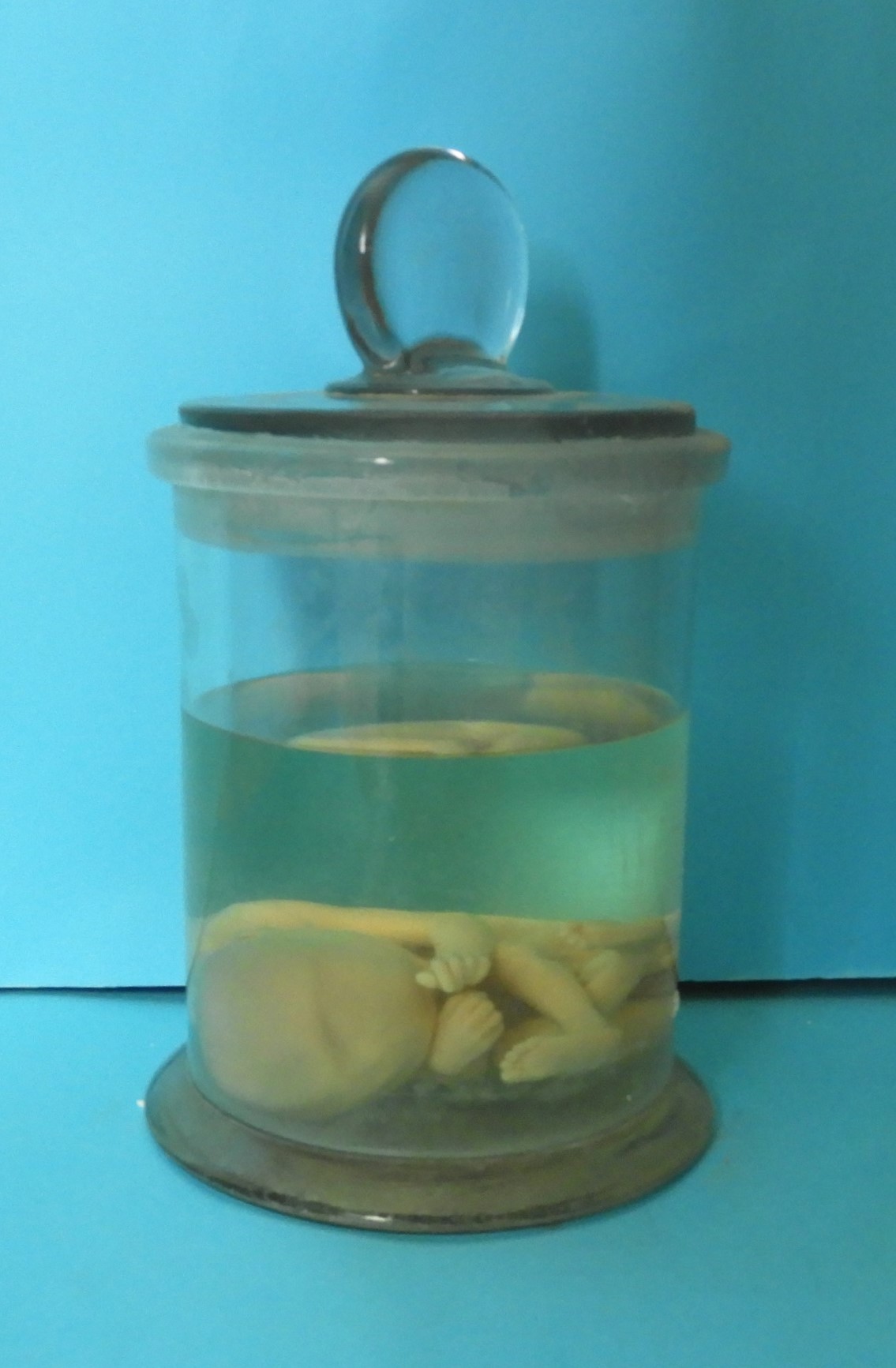 preparato anatomico, feto (morfologia naturale) (prima metà SECOLI/ XIX)