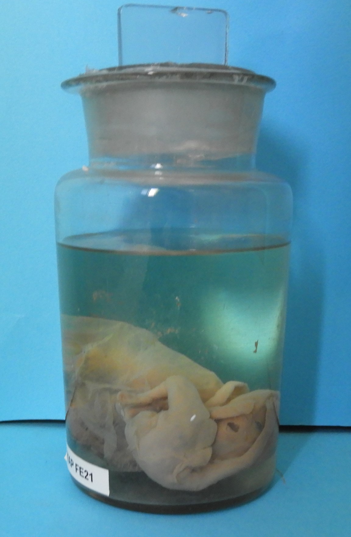 preparato anatomico, feto (morfologia naturale) (prima metà SECOLI/ XIX)