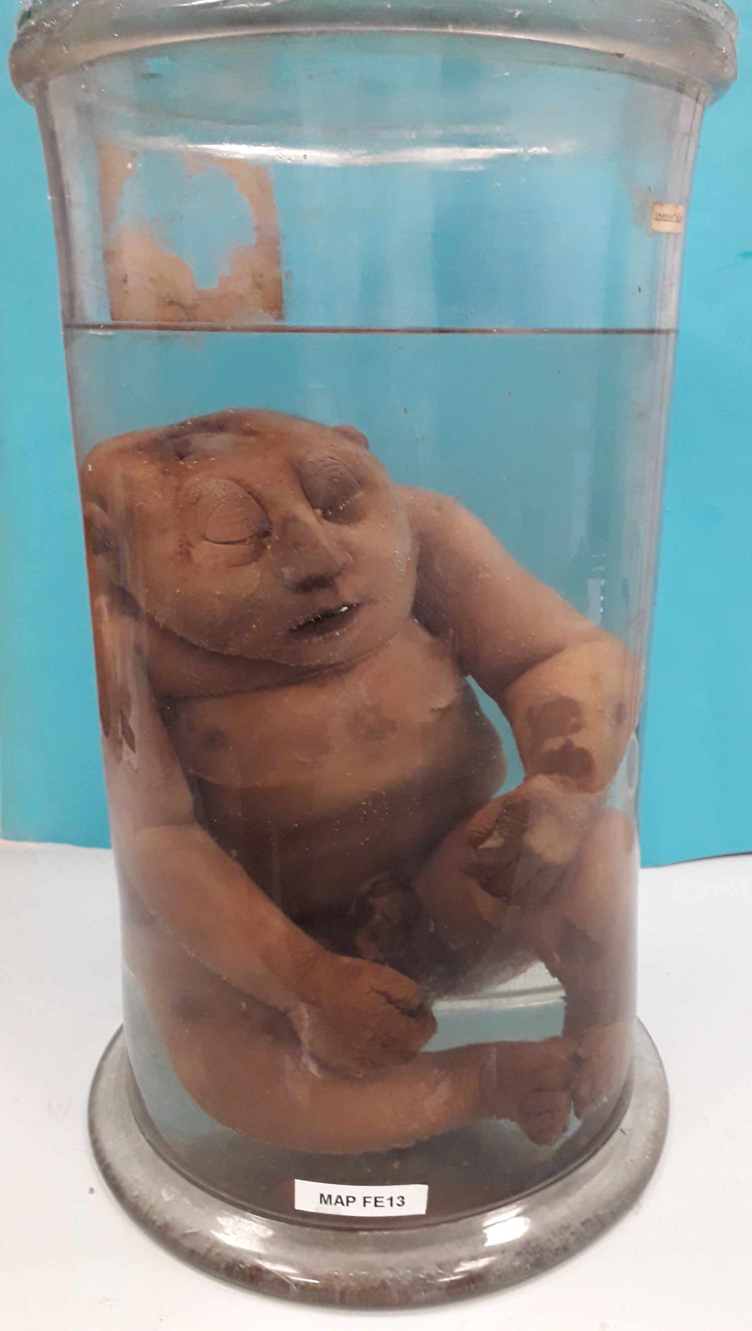 preparato anatomico, feto (morfologia naturale) (prima metà SECOLI/ XIX)