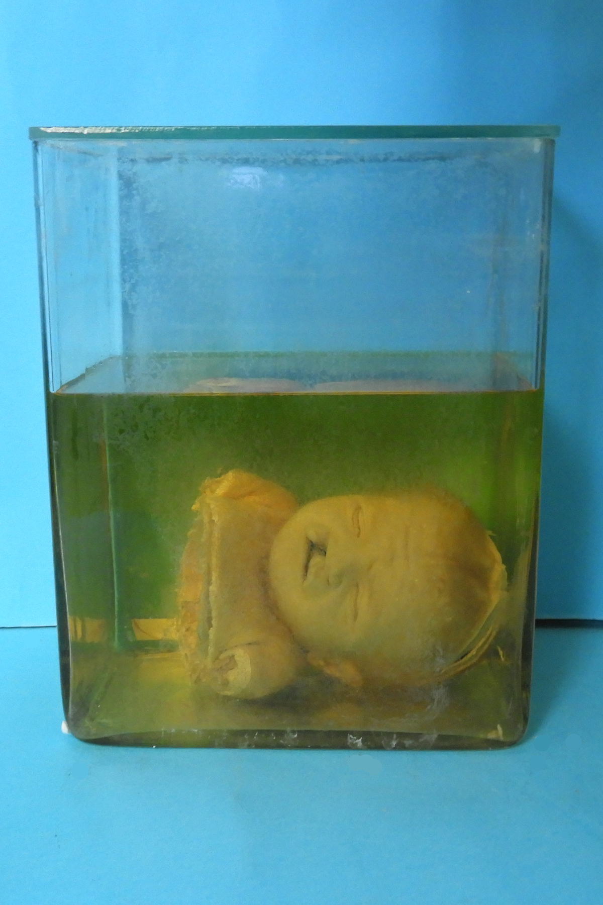 preparato anatomico, feto (morfologia naturale) (prima metà SECOLI/ XIX)