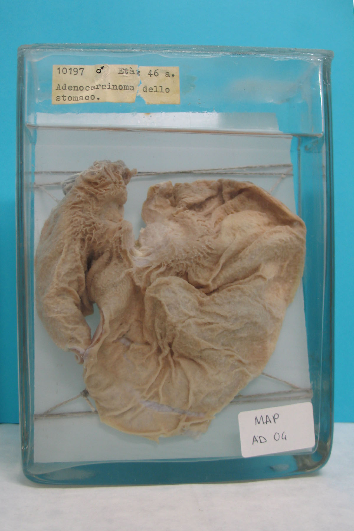 preparato anatomico, apparato digerente (morfologia naturale) (SECOLI/ XX)