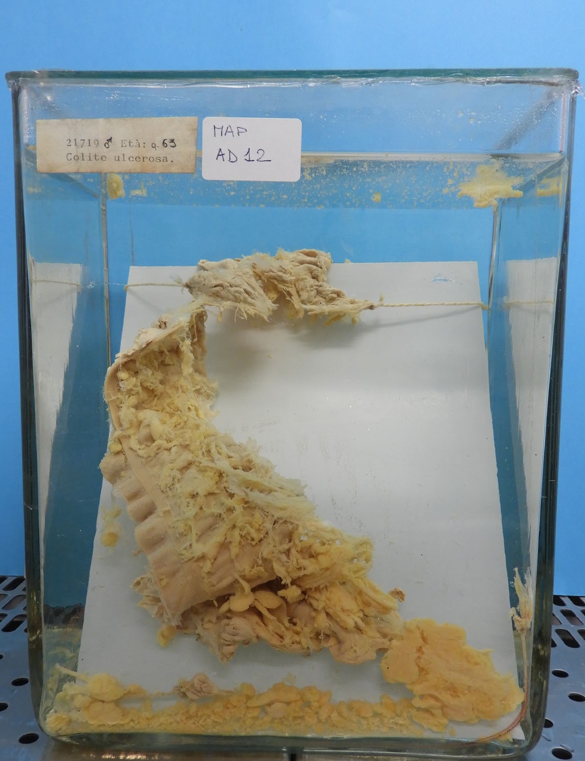 preparato anatomico, apparato digerente (morfologia naturale) (SECOLI/ XX)