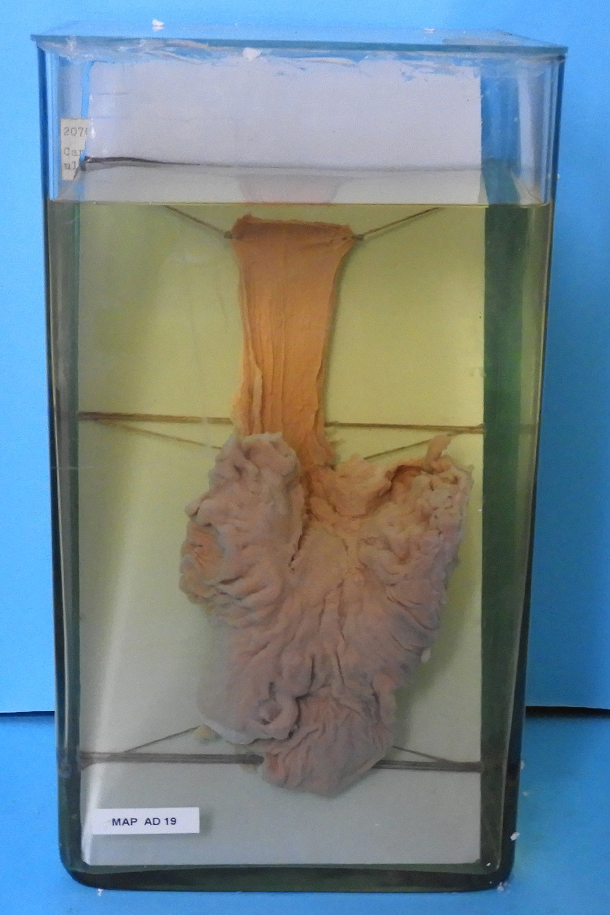 preparato anatomico, apparato digerente (morfologia naturale) (SECOLI/ XX)