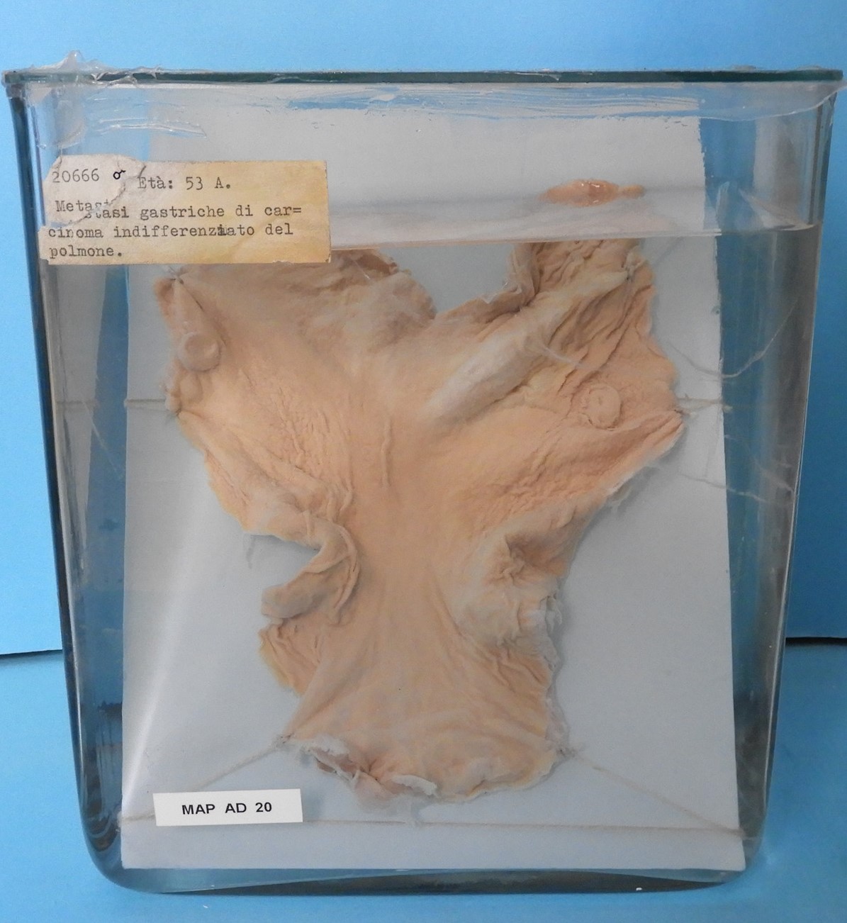 preparato anatomico, apparato digerente (morfologia naturale) (SECOLI/ XX)