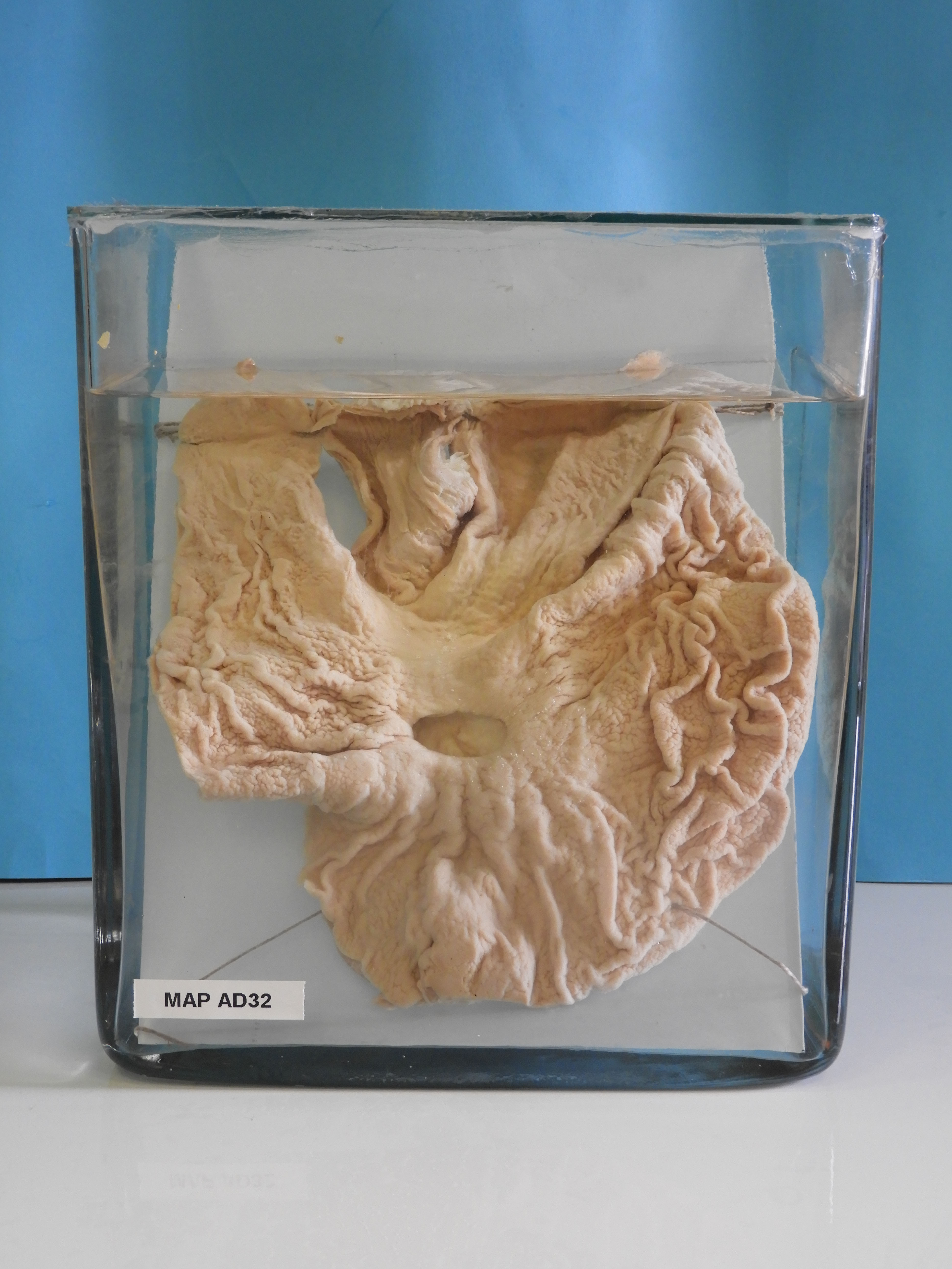 preparato anatomico, apparato digerente (morfologia naturale) (SECOLI/ XX)