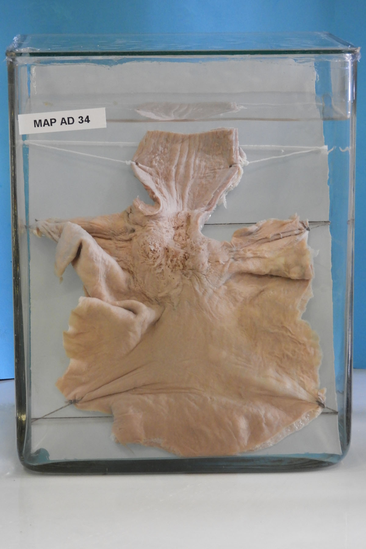 preparato anatomico, apparato digerente (morfologia naturale) (SECOLI/ XX)