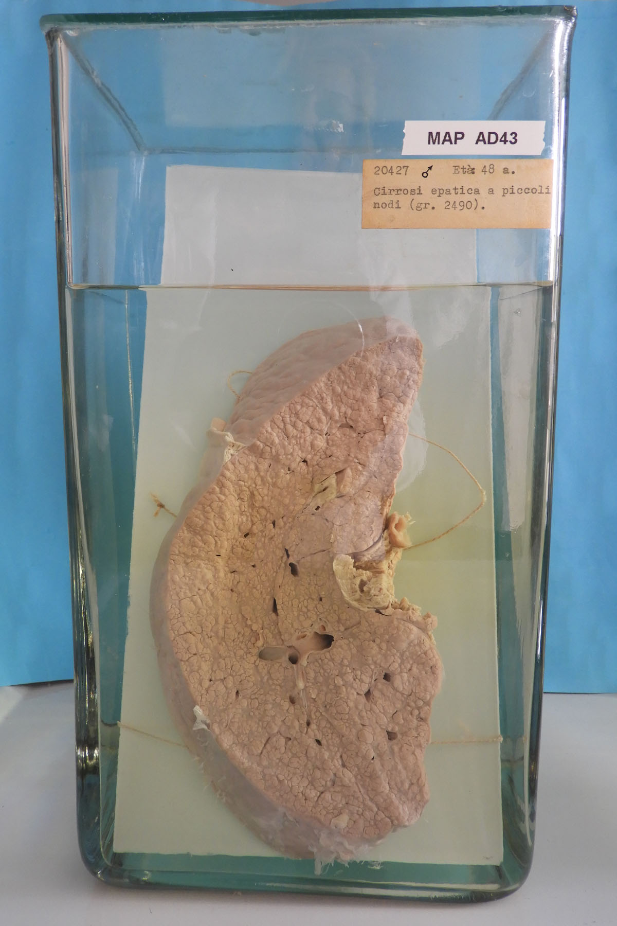 preparato anatomico, apparato digerente (morfologia naturale) (SECOLI/ XX)