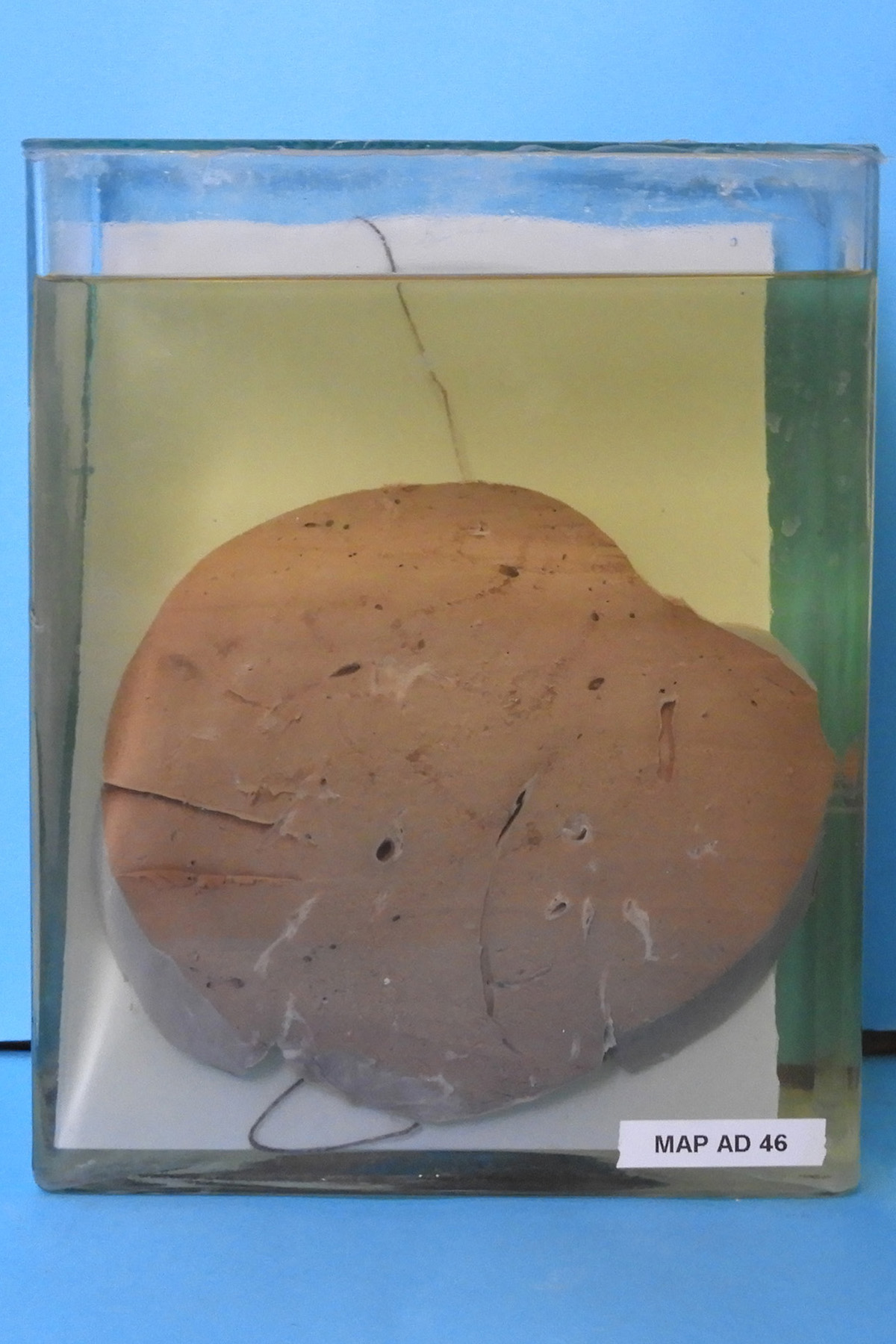 preparato anatomico, apparato digerente (morfologia naturale) (SECOLI/ XX)