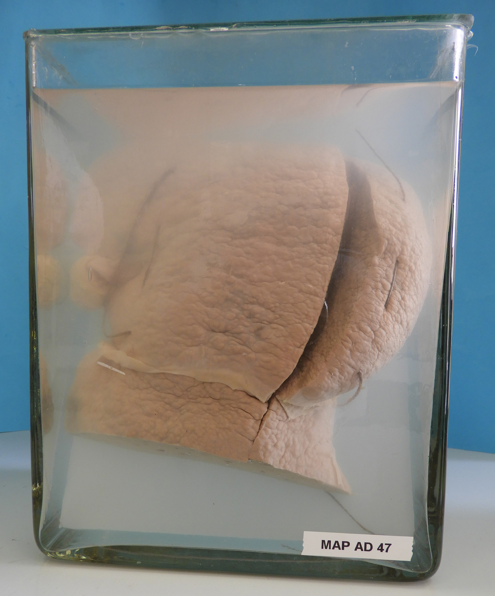 preparato anatomico, apparato digerente (morfologia naturale) (SECOLI/ XX)